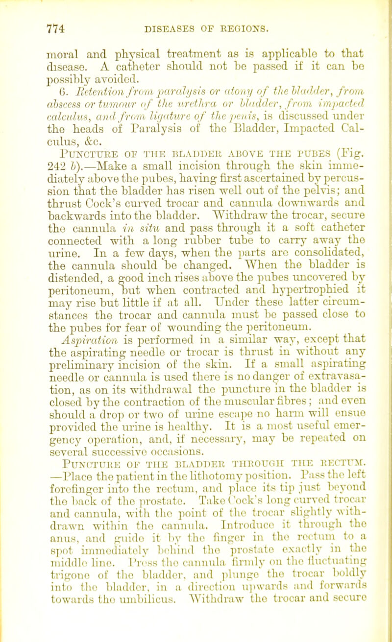 moral and physical ti'eatment as is applicable to that disease. A catheter should not he passed if it can bo possibly avoided. 6. Retention/vdui jmi-alijsis or (itouy of the hhnhler, from abscess or tumour nf the urctJira or hhiddcr, fnnn imjiarltd calcnhis, and from li<jidure of the penis, is disciLSsed under the heads of Paralysis of the T31adder, Impacted Cal- culus, &c. Puncture of TirE eladder above the tubes (Fig. 242 V).—Make a small incision through the .skin imme- diately above the pubes, having fii'st ascertained by percus- sion that the bladder has risen well out of the pelvis; and thrust Cock's cui'ved trocar and cannula downwards and backwards into the bladder. Withdraw the trocar, secure the cannula in situ and pass through it a soft catheter connected with a long rubber tube to carry away the urine. In a few days, when the parts are consolidated, the cannula should be changed. When the bladder is distended, a good inch rises above the pubes uncovered by peritoneum, but when contracted and hypertrophied it may rise but little if at aU. Under these latter circum- stances the trocar and cannula must be passed close to the pubes for fear of wounding the peritouetmi. Asjnratio/i, is performed in a similar way, except that the aspirating needle or trocar is thrust in without any preliminary incision of the skin. If a small aspirating needle or cannula is used there is no danger of extravasa- tion, as on its withdrawal the puncture in the bladder is closed by the contraction of the muscular fibres; and even should a drop or two of urine escape no harm will ensue provided the urine is healthy. It is a most useful emer- gency operation, and, if necessary, may be repeated on several successive occa.sions. Puncture of the bl.vduer throuiui the ]!KCTU>r. —Place the patient in the Utliotomy position. Pass the left forefinger into the rectum, and place its tip just beyond the back of the i)rostato. Take ('ock's long curved trocar and cannula, with tlio point of the trocar .slightly with- drawn within the cannula. Introduce it throiigh the anus, and guide it by ih(> finger in the rectum to a sj)ot immcdiatolv bch'ind the 'pro.state exactly in the middle lino. Pn'ss tlie cannula finuly on the iluctuatnig trigone of Iho bladder, and jilunge the trocar boldly into iho. bladder, in a direction u]iwards and forwards towards the umbilicus. Withdraw the trocar and secure