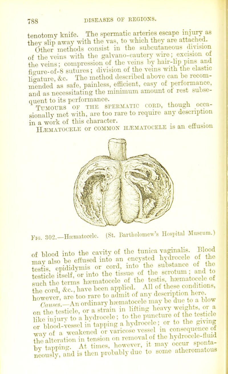 tenotomy knife. The spermatic arteries escape injury as they slip away with the vas, to which they are attached. Other methods consist in the subcutaneous division of the veins with the galvano-cauterj- wii-e; excision ot the veins; compression of the veins by hair-hp pms and fio-ure-of-8 sutures ; division of the veins with the elastic ligature &c. The method described above can be recom- mended'as safe, painless, efficient, easy of performance, and as necessitating the minimum amoimt ot rest subse- quent to its performance. TuMOUES OF THE SPERiLVTic CORD, though occa- sionally met ^^-ith, are too rare to requii-e any description in a work of this character. . . HiEMATOCELE Or OOMMOX H.'EMATOCELE IS an eftUSlOU Pj,,. 30-2._Hreraatocelc. (St. ^,artholomc^v's Hospital Museum.) of blood into the caAdty of the tunica vaginalis. Mood may also be effused into an encysted hydrocele of the testis epididymis or cord, into the substance of the test cic itsSf,^or into the tissue of the scrotum ; and to such the terms hrcmatoccle of the testis hromatocele of cord &c , have been applied. All of those conditions, Wnvo are too rare to admit of any description here ^T,^i-An ordinary ha.natocolc maybe duo to a Mow /T,n Wiclo or a strain in lifting honxy weights, or a on t^^^ost cte 01 a p'^n.eturo of the testicle ^S-veSo Ste ^iiiahydriolo: or to the giving wav of a weakencHl or varicose vessel m consociuonce o Th?altorat^n in tension on removal of the hyclrocclo-lliiid bv t unin-. At times, howevc-r, it may <^cciir .'sponta- neously ud is then probably due to some atheromatous