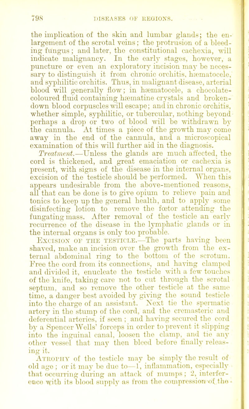 the implication of the skin and lumbar glands; the en- largement of the scrotal veins; the protrusion of a bleed- ing fungus; and later, the constitutional cachexia, will indicate malignancy. In the earl}- stages, however, a jDuncture or even an exploratory^ incision may be neces- sary to distinguish it from chronic orchitis, hfematocele, and syphilitic orchitis. Thus, in malignant disease, arterial blood will generally flow; in hsematocele, a chocolate- coloured fluid containing htematine crystals and broken- down blood corpuscles will escape; and in chronic orchitis, whether simple, syphilitic, or tubercular, nothing beyond- perhaps a drop or two of blood will be withdrawn by the cannula. At times a piece of the growth may come away in the end of the cannula, and a microscopical examination of this will further aid in the diagnosis. Treatment.—Unless the glands are much affected, the cord is thickened, and great emaciation or cachexia is l^resent, with signs of the disease in the internal organs, excision of the testicle should be performed. TSTieu this ajjpears undesirable from the above-mentioned reasons, all that can be done is to give opium to relieve pain and tonics to keep up the general health, and to apply some disinfecting lotion to remove the fcetor attending the fungating mass. After removal of the testicle an eai'ly recurrence of the disease in the lymphatic glands or in the internal organs is only too probable. Excisiox OE TUE TESTICLE.—The parts ha\-ing been shaved, make an incision over the growth from the ex- tei'nal abdominal ring to the bottom of the scrotum. Free the cord from its connections, and having clamped and divided it, enucleate the testicle witli a few touches of the knife, taking care not to cut through the scrotal septum, and so remove the other testicle at the .-iamc time, a danger best avoided by giving the sound testicle into the charge of an assistant. Next tie the spermatic artery in the stump of the cord, and the cremasteric and dcfeixuitial arteries, if seen ; and having secured the cord by a Spencer Wells' forceps in order to prevent it slipping iiito the inguinal canal, loosen the clump, and tie nny other vessel that may tlicn bleed before finally releas- ing it. Atuotiiv of the testicle may be simply the result of old age ; or it may be due to—1, inllammation, especiiilly that occurring during an attack of mumps; 2, intorfer- ODco with it.i l)lood supply as from the compression of the -