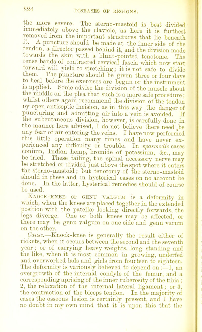 the more severe. The sterno-mastoid is best divided immediately above the clavicle, as here it is fuithest removed from the important structm-es that lie beneath it. A. puncture should be made at the inner side of the tendon, a director passed behind it, and the division made towards the skin with a blunt-pointed tenotome. The tense bands of contracted cervical fascia which now start forward will yield to stretching; it is not safe to divide them. The punctm-e should be given thi-ee or four days to heal before the exercises are begun or the instrument is applied. Some advise the division of the muscle about the middle on the jalea that such is a more .safe procedui-e ; whilst others again recommend the division of the tendon Dy open antiseptic incision, as in this way the danger of puncturing and admittiug aii- into a vein is avoided. If the subcutaneous division, however, is carefully done in the manner here advised, I do not believe there need ,be any fear of air entering the veins. I have now performed this little operation many times and have never ex- perienced any difficulty or trouble. In spasmodic cases conium, IncUan hemp, bromide of potassium, &c., may be tried. These failing, the spinal accessory nerve may be stretched or divided just above the spot where it enters the sterno-mastoid ; but tenotomy of the sterno-mastoid should in these and in hysterical cases on no account be done. In the latter, hysterical remedies should of coiu-se be used. IpfOCK-KNEE or GENU VALGXTii is a defoiTnitj- in which, when the knees are placed together in the extended position with the patellte looking directly foi-wards, the legs diverge. One or both luiees may lie aifected, or there may be genu valgum on one side and genu varum on the other. Cawse.—Knock-knee is generally the result either of I'ickets, when it occurs between the second and the seventh year; or of carrying heavy weights, long standing and the like, when it is most common in growing, underfed and overwoi'ked lads and girls from fourteen to eighteen. The deformity is variously believed to depend on:—1, an overgrowth of the internal condyle of the femur, and a corresiionding uprising of the inner tuberosity of the tibia ; 2, the relaxiition of the internal lateral ligament; or '6. the contraction of the biceps tendon. In the majority of cases the osseous lesion is certainly iiresent, and I liave no doubt in my own mind that it is upon this that the