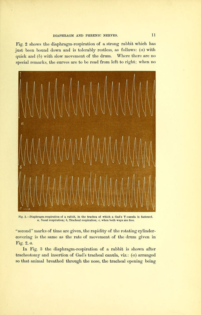 Fig. 2 shows the diaphragm-respiration of a strong rabbit which has just been bound down and is tolerably restless, as follows: {a) with quick and (6) with slow movement of the drum. Where there are no special remarks, the curves are to be read from left to right; when no Fig. 3.—Diaphragm-respiration of a rabbit, in the trachea of which a Gad's T-canula is fastened. a. Nasal respiration; &, Tracheal respiration; c, when both ways are free. second marks of time are given, the rapidity of the rotating cylinder- covering is the same as the rate of movement of the drum given in Fig. 2, a. In Fig. 3 the diaphragm-respiration of a rabbit is shown after tracheotomy and insertion of Gad's tracheal canula, viz.: {a) arranged so that animal breathed through the nose, the tracheal opening being