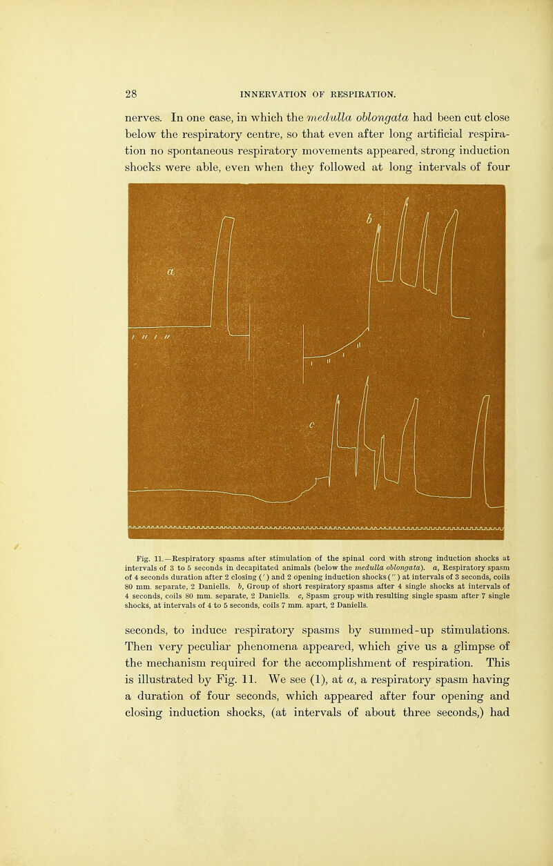 nerves. In one case, in which the medulla oblongata had been cut close below the respiratory centre, so that even after long artificial respira- tion no spontaneous respiratory movements appeared, strong induction shocks were able, even when they followed at long intervals of four Fig. 11.—Respiratory spasms after stimulation of the spinal cord with strong induction shocks at intervals of 3 to 5 seconds in decapitated animals (below the medulla oblongata), a. Respiratory spasm of 4 seconds duration after 2 closing (') and 2 opening induction shocks () at intervals of 3 seconds, coils 80 mm. separate, 2 Daniells. b, Group of short respiratory spasms after i single sliocks at intervals of 4 seconds, coils 80 mm. separate, 2 Daniells. c. Spasm group with resulting single spasm after 7 single shocks, at intervals of 4 to 5 seconds, coils 7 mm. apart, 2 Daniells, seconds, to induce respiratory spasms by summed-up stimulations. Then very peculiar phenomena appeared, which give us a glimpse of the mechanism required for the accomplishment of respiration. This is illustrated by Fig. 11. We see (1), at a, a respiratory spasm having a duration of four seconds, which appeared after four opening and closing induction shocks, (at intervals of about three seconds,) had