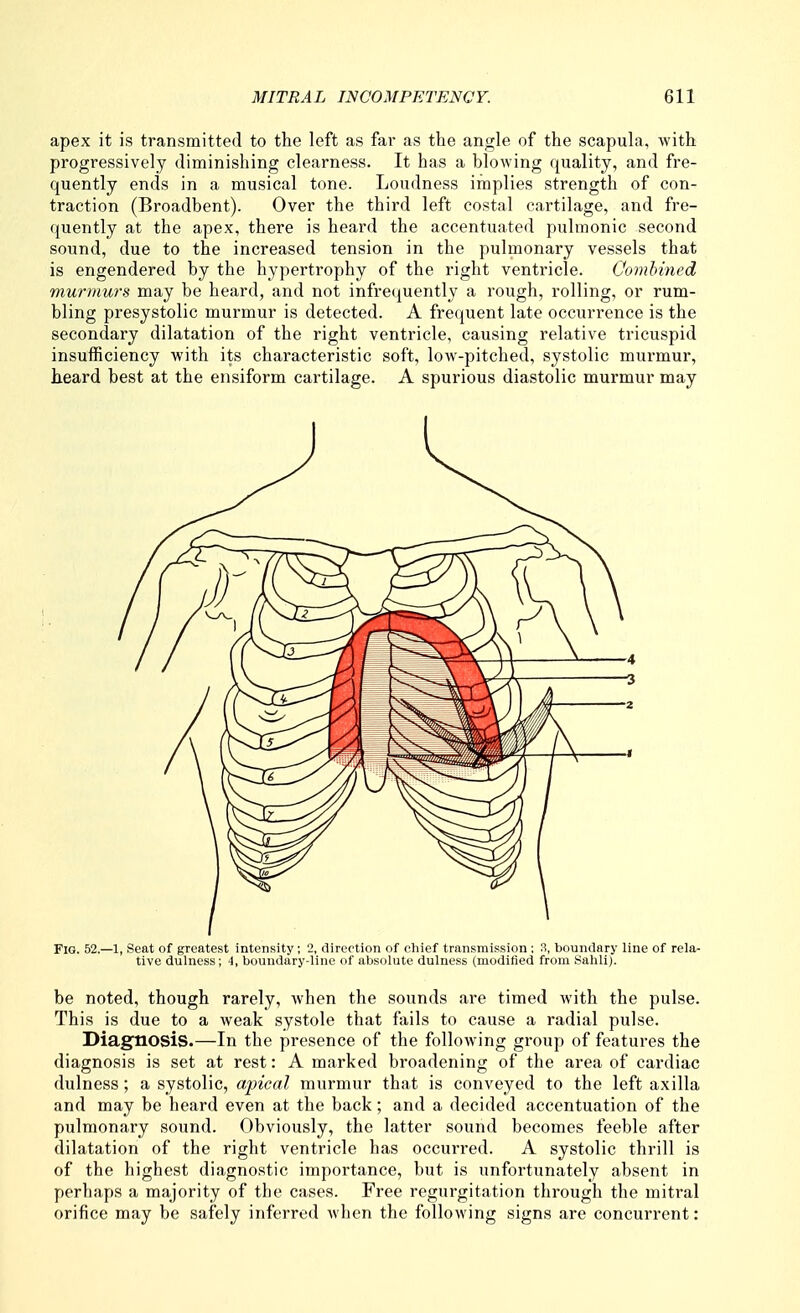 apex it is transmitted to the left as far as the angle of the scapula, with progressively diminishing clearness. It has a blowing quality, and fre- quently ends in a musical tone. Loudness implies strength of con- traction (Broadbent). Over the third left costal cartilage, and fre- quently at the apex, there is heard the accentuated pulmonic second sound, due to the increased tension in the pulmonary vessels that is engendered by the hypertrophy of the right ventricle. Comhincd murmurs may be heard, and not infrequently a rough, rolling, or rum- bling presystolic murmur is detected. A frequent late occurrence is the secondary dilatation of the right ventricle, causing relative tricuspid insufficiency with its characteristic soft, low-pitched, systolic murmur, heard best at the eiisiform cartilage. A spurious diastolic murmur may Fig. 52.—1, Seat of greatest intensity; 2, direction of chief transmission: 3, boundary line of rela- tive dulness; 4, boundary-line of absolute dulness (modified from Sahli). be noted, though rarely, Avhen the sounds are timed with the pulse. This is due to a weak systole that fails to cause a radial pulse. Diagnosis.—In the presence of the following group of features the diagnosis is set at rest: A marked broadening of the area of cardiac dulness; a systolic, apical murmur that is conveyed to the left axilla and may be heard even at the back; and a decided accentuation of the pulmonary sound. Obviously, the latter sound becomes feeble after dilatation of the right ventricle has occurred. A systolic thrill is of the highest diagnostic importance, but is unfortunately absent in perhaps a majority of the cases. Free regurgitation through the mitral orifice may be safely inferred Avhen the following signs are concurrent: