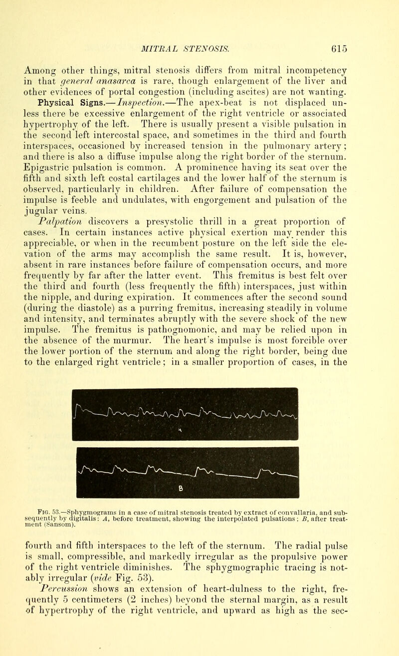 Among other things, mitral stenosis differs from mitral incompetency in that general anasarca is rare, though enlargement of the liver and other evidences of portal congestion (including ascites) are not wanting. Physical Signs.—Inspection.—The apex-beat is not displaced un- less there be excessive enlargement of the right ventricle or associated hypertrophy of the left. There is usually present a visible pulsation in the second left intercostal space, and sometimes in the third and fourth interspaces, occasioned by increased tension in the pulmonary artery; and there is also a diffuse impulse along the right border of the sternum. Epigastric pulsation is common. A prominence having its seat over the fifth and sixth left costal cartilages and the lower half of the sternum is observed, particularly in children. After failure of compensation the impulse is feeble and undulates, with engorgement and pulsation of the jugular veins. Palpation discovers a presystolic thrill in a great proportion of cases. In certain instances active physical exertion may render this appreciable, or Avhen in the recumbent posture on the left side the ele- vation of the arms may accomplish the same result. It is, however, absent in rare instances before failure of compensation occurs, and more frequently by far after the latter event. This fremitus is best felt over the third and fourth (less frequently the fifth) interspaces, just Avithin the nipple, and during expiration. It commences after the second sound (during the diastole) as a purring fremitus, increasing steadily in volume and intensity, and terminates abruptly with the severe shock of the new impulse. The fremitus is pathognomonic, and may be relied upon in the absence of the murmur. The heart's impulse is most forcible over the lower portion of the sternum and along the right border, being due to the enlarged right ventricle; in a smaller proportion of cases, in the Fig. 53.—Sphygmograms in a case of mitral stenosis treated by extract of convallaria, and sub- sequently by digitalis: A, before treatment, showing the interpolated pulsations ; B, after treat- ment (Sansom). fourth and fifth interspaces to the left of the sternum. The radial pulse is small, compressible, and markedly irregular as the propulsive power of the right ventricle diminishes. The sphygmographic tracing is not- ably irregular {inde Fig. 53). Percussion shows an extension of heart-dulness to the right, fre- quently 5 centimeters (2 inches) beyond the sternal margin, as a result of hypertrophy of the right ventricle, and upward as high as the sec-