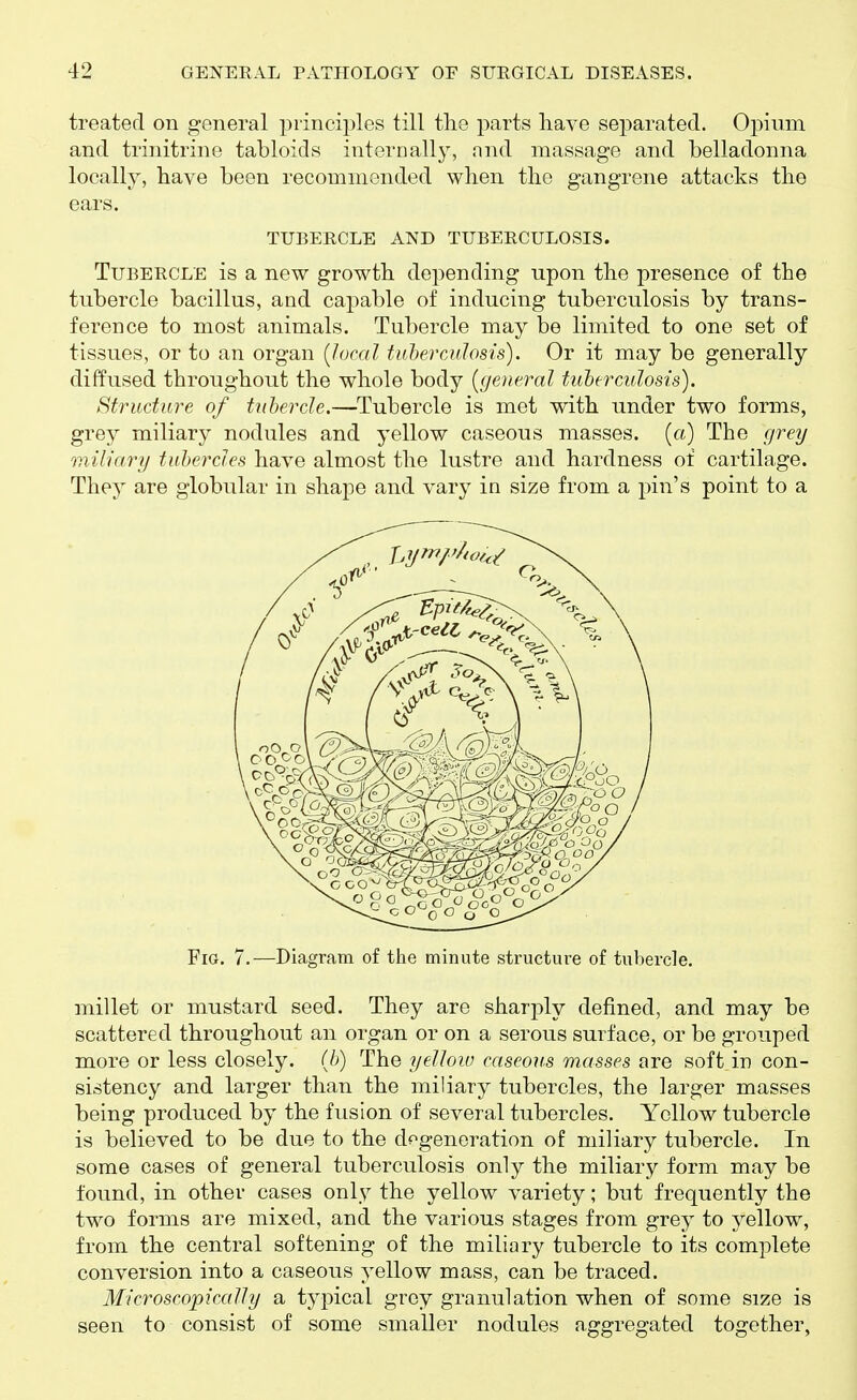 treated on general piincii^les till the parts have separated. Opium and trinitrine tabloids internally, and massage and belladonna locally, have been recommended when the gangrene attacks the ears. TUBERCLE AND TUBERCULOSIS. Tubercle is a new growth depending upon the presence of the tubercle bacillus, and capable of inducing tuberculosis by trans- ference to most animals. Tubercle may be limited to one set of tissues, or to an organ [loccd taherculosis). Or it may be generally diffused throughout the whole body {general tiibermiosis). Structure of tuherde,—Tubercle is met with under two forms, grey miliary nodules and yellow caseous masses, (a) The grey miliary tuhercles have almost the lustre and hardness of cartilage. They are globular in shape and vary in size from a pin's point to a Fig. 7.—Diagram of the minute structure of tubercle. millet or mustard seed. They are sharply defined, and may be scattered throughout an organ or on a serous surface, or be grouped more or less closely, (b) The yellow caseous masses are soft in con- sistency and larger than the miliary tubercles, the larger masses being produced by the fusion of several tubercles. Yellow tubercle is believed to be due to the degeneration of miliary tubercle. In some cases of general tuberculosis only the miliary form may be found, in other cases only the yellow variety; but frequently the two forms are mixed, and the various stages from grey to yellow, from the central softening of the miliary tubercle to its complete conversion into a caseous yellow mass, can be traced. Microscopically a typical grey granulation when of some size is seen to consist of some smaller nodules aggregated together,