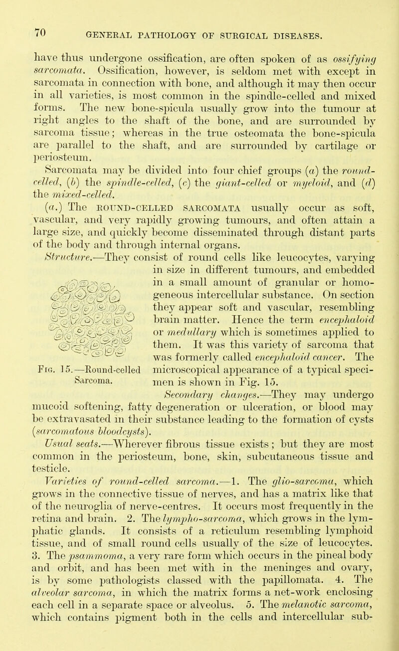 have thus undergone ossification, are often spoken of as ossifying sarcomata. Ossification, however, is seldom met with except in sarcomata in connection with bone, and although it may then occur in all varieties, is most common in the spindle-celled and mixed forms. The new bone-spicula usually grow into the tumour at right angles to the shaft of the bone, and are surrounded by sarcoma tissue; whereas in the true osteomata the bone-spicula are parallel to the shaft, and are surrounded by cartilage or periosteum. Sarcomata may be divided into four chief groups (a) the round- celled, [h) the spindh-ceUed, (c) the giant-celled or myeloid, and [d) the mixed-celled. (a.) The round-celled sarcomata usually occur as soft, vascular, and very rapidly growing tumours, and often attain a large size, and quickly become disseminated through distant parts of the body and through internal organs. Sfructfire.—They consist of round cells like leucocytes, varying in size in different tumours, and embedded ^ '5)^^ -A in a small amount of granular or homo- ^  ^ ^ geneous intercellular substance. On section ^ , , - 1 they appear soft and vascular, resembling ,. _ . - vJ brain matter. Hence the term encephaloid , ^ ^ ^ or medidlary which is sometimes applied to \^rz ^ them. It was this variety of sarcoma that '~~ ~ ^ ^ ^ was formerly called encephaloid cancer. The Fig. 15.—Round-celled microscopical appearance of a typical speci- Sarcoma. i^ien is shown in Fig. 15. Secondary changes.—They may undergo mucoid softening, fatty degeneration or ulceration, or blood may be extravasated m theii' substance leading to the formation of cysts (sarcomatous bloodcysts). Usual seats.—Wherever fibrous tissue exists ; but they are most common in the periosteum, bone, skin, subcutaneous tissue and testicle. Varieties of round-celled sarcoma.—1. The glio-sarcoma, which grows in the connective tissue of nerves, and has a matrix like that of the neuroglia of nerve-centres. It occurs most frequently in the retina and brain. 2. The lymphosarcoma, which grows in the lym- phatic glands. It consists of a reticulum resembling lymphoid tissue, and of small round cells usually of the size of leucocytes. 3. The psammoma, a very rare form which occurs in the pineal body and orbit, and has been met with in the meninges and ovary, is by some pathologists classed with the papillomata. 4. The alveolar sarcoma, in which the matrix forms a net-work enclosing each cell in a separate space or alveolus. 5. The melanotic sarcoma, which contains pigment both in the cells and intercellular sub-