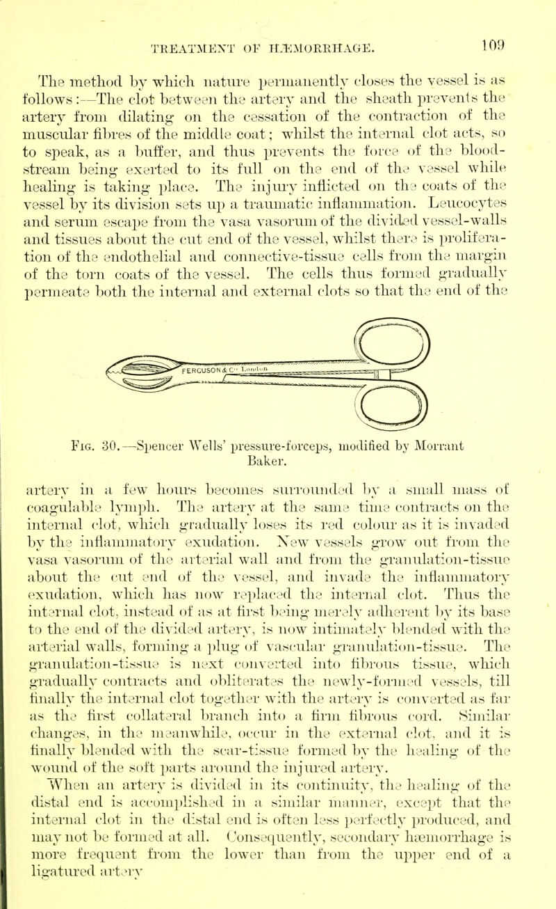 treat:mext of tlilmorehage. The method by which nature periiiciiieiitlv closes the vessel is as follows :—The clot between the artery and the sheath prevents the artery from dilating on the cessation of the contraction of the muscular fibres of the middle coat; whilst the internal clot acts, so to speak, as a buffer, and thus prevents the force of the blood- stream being exerted to its full on the end of the vessel while healing is taking place. The injm'y inflicted on thy coats of the vessel by its division sets up a traumatic; inflammation. Leucocytes and serum escape from the vasa vasorum of the divided vessel-walls and tissues about the cut end of the vessel, whilst there is prolifera- tion of the endothelial and connective-tissue cells from the margin of the torn coats of the vessel. The cells thus formed gradually permeate both the internal and external clots so that the end of the Fig. 30.—Spencer Wells' pressure-forceps, modified by Morrant Baker. artery in a few h(jurs becomes siuTouiided l)y a small mass of coagulable lymph. The artery at the same time contracts on the internal clot, which gradually loses its red colour as it is invaded by the inflammatory exudation. Xew vessels grow out from the vasa vasorum of the arterial wall and from the granulation-tissue about the cut ;'nd of the vessel, and invade the inflammatory exudation, which has now replaced the internal clot. Thus the intarnal clot, instead of as at first being merely adherent by its base to the end of the divided artery, is now intimately blended with the arterial walls, forming a plug of vascular granulation-tissue. The granulation-tissue is next converted into fibrous tissue, which gradually contracts and obliterates the newly-formed vessels, till finally the internal clot together with the artery is converted as far as the first collateral branch into a firm fibrous cord. Similar changes, in the meanwhile, occur in the external clot, and it is finally blended with the scar-tissue formed by the healing of the wound of the soft parts around the injured artery. When an artery is divided in its continiuty, the healing of the distal end is accomplished in a similar manner, except that the int ernal clot in the distal end is often less perfectly produced, and may not be formed at all. Conset][uently, secondary haemorrhage is more frequent from the lower than from the upper end of a ligatured artvM'y