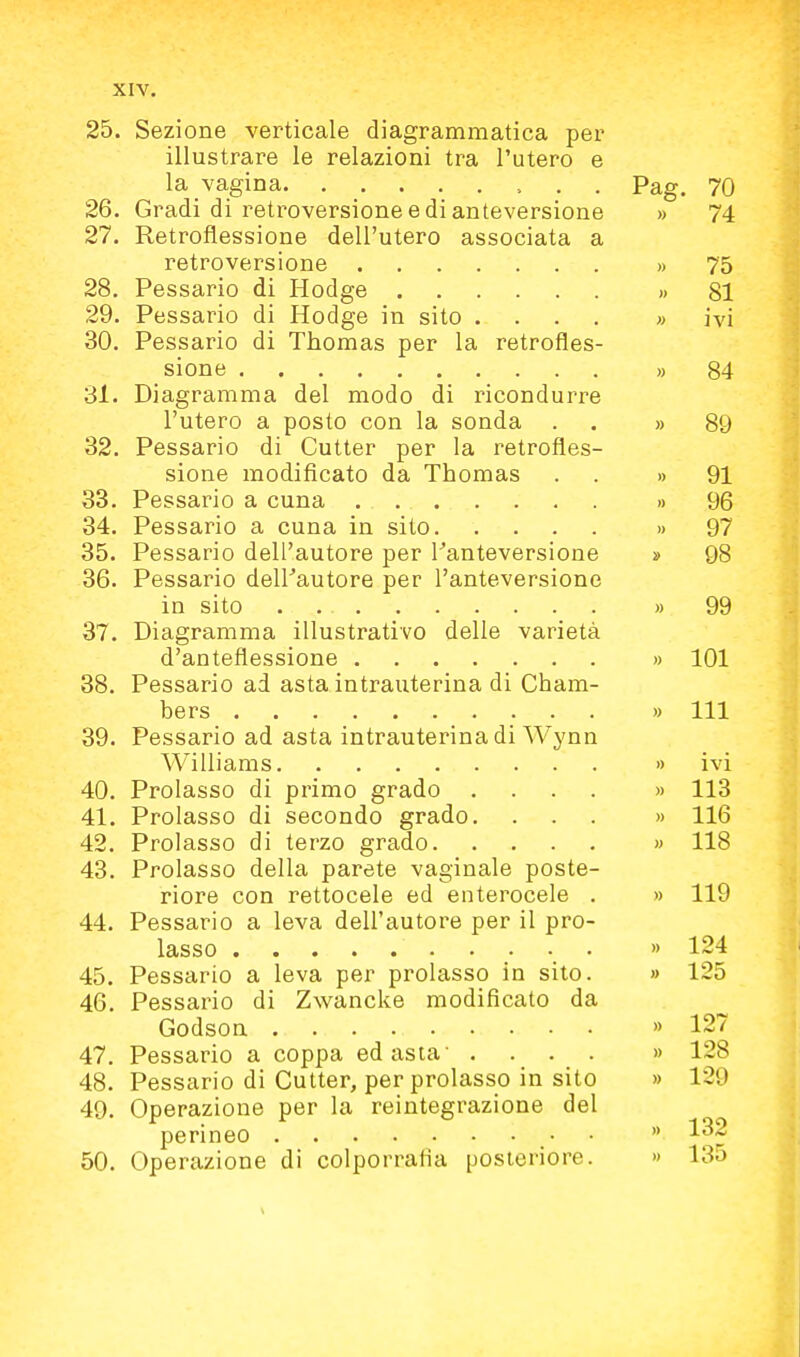 25. Sezione verticale diagrammatica per illustrare le relazioni tra l'utero e la vagina. ........ Pag. 70 26. Gradi di retroversione e di anteversione » 74 27. Retroflessione dell'utero associata a retroversione » 75 28. Pessario di Hodge » 81 29. Pessario di Hodge in sito .... » ivi 30. Pessario di Thomas per la retrofles- sione » 84 31. Diagramma del modo di ricondurre l'utero a posto con la sonda . . » 89 32. Pessario di Cutter per la retrofles- sione modificato da Thomas . . » 91 33. Pessario a cuna » 96 34. Pessario a cuna in sito » 97 35. Pessario dell'autore per Tanteversione » 98 36. Pessario deirautore per l'anteversione in sito » 99 37. Diagramma illustrativo delle varietà d'anteflessione » 101 38. Pessario ad asta intrauterina di Cham- bers » 111 39. Pessario ad asta intrauterina di Wynn Williams » ivi 40. Prolasso di primo grado .... » 113 41. Prolasso di secondo grado. ... » 116 42. Prolasso di terzo grado « 118 43. Prolasso della parete vaginale poste- riore con rettocele ed enterocele . » 119 44. Pessario a leva dell'autore per il pro- lasso » 124 45. Pessario a leva per prolasso in sito. » 125 46. Pessario di Zwancke modificato da Godson » 12~ 47. Pessario a coppa ed asta' .... » 128 48. Pessario di Cutter, per prolasso in sito » 129 49. Operazione per la reintegrazione del perineo  50. Operazione di colporrafia posteriore. » 135