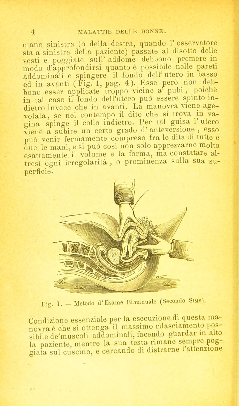 mano sinistra (o della destra, quando 1' osservatore sta a sinistra della paziente) passate al disotto delle ■vesti e poggiate suU' addome debbono premere in modo d'approfondirsi quanto è possibile nelle pareti addominali e spingere il fondo dell' utero in basso ed in avanti ( Fig. 1, pag. 4). Esse però non deb- bono esser applicate troppo vicine a' pubi, poiché in tal caso il fondo dell'utero può essere spinto in- dietro invece che in avanti. La manovra viene age- volata, se nel contempo il dito che si trova in va- gina spinge il collo indietro. Per tal guisa 1' utero viene a subire un certo grado d' anteversione , esso può venir fermamente compreso fra le dita di tutte e due le mani, e si può cosi non solo apprezzarne molto esattamente il volume e la forma, ma constatare al- tresì ogni irregolarità , o prominenza sulla sua su- perficie. Fig. 1. _ Metodo d'Esame Bimanuale (Secondo SiMS). Condizione essenziale per la esecuzione di questa ma- novra è che si ottenga il massimo rilasciamento pos- sibile de'muscoli addominali, facendo guardar in alto la paziente, mentre la sua testa rimane sempre pog- giata sul cuscino, e cercando di distrarne 1 attenzione