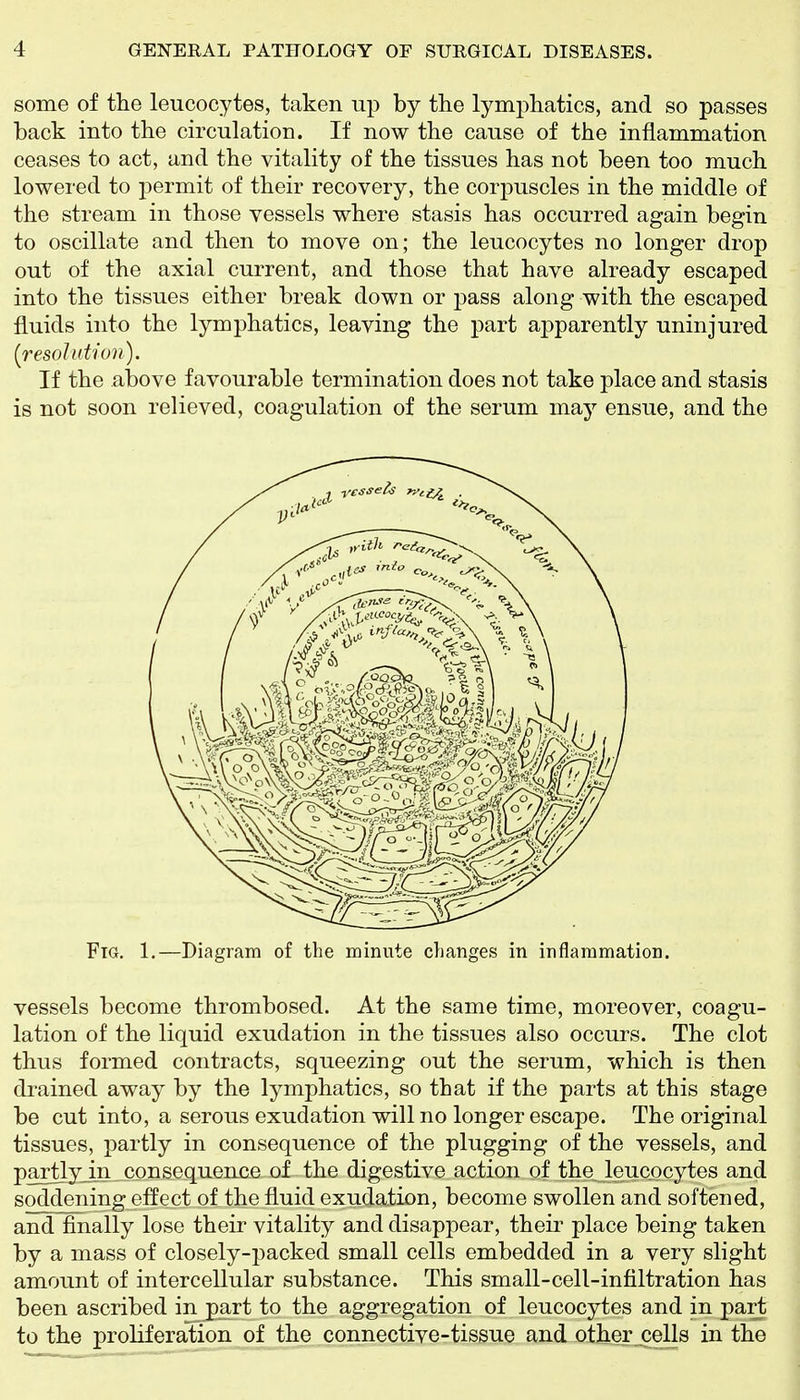 some of the leucocytes, taken up by the lymphatics, and so passes back into the circulation. If now the cause of the inflammation ceases to act, and the vitality of the tissues has not been too much lowered to permit of their recovery, the corpuscles in the middle of the stream in those vessels where stasis has occurred again begin to oscillate and then to move on; the leucocytes no longer drop out of the axial current, and those that have already escaped into the tissues either break down or pass along with the escaped fluids into the lymphatics, leaving the part apparently uninjured (resolution). If the above favourable termination does not take place and stasis is not soon relieved, coagulation of the serum may ensue, and the Fig. 1.—Diagram of the minute changes in inflammation. vessels become thrombosed. At the same time, moreover, coagu- lation of the liquid exudation in the tissues also occurs. The clot thus formed contracts, squeezing out the serum, which is then drained away by the lymphatics, so that if the parts at this stage be cut into, a serous exudation will no longer escape. The original tissues, partly in consequence of the plugging of the vessels, and partly in consequence of the digestive action of the leucocytes and soddening effect of the fluid exudation, become swollen and softened, and finally lose their vitality and disappear, their place being taken by a mass of closely-packed small cells embedded in a very slight amount of intercellular substance. This small-cell-infiltration has been ascribed in jgart to the aggregation of leucocytes and in part to the proliferation of the connective-tissue and^ther_cells in the