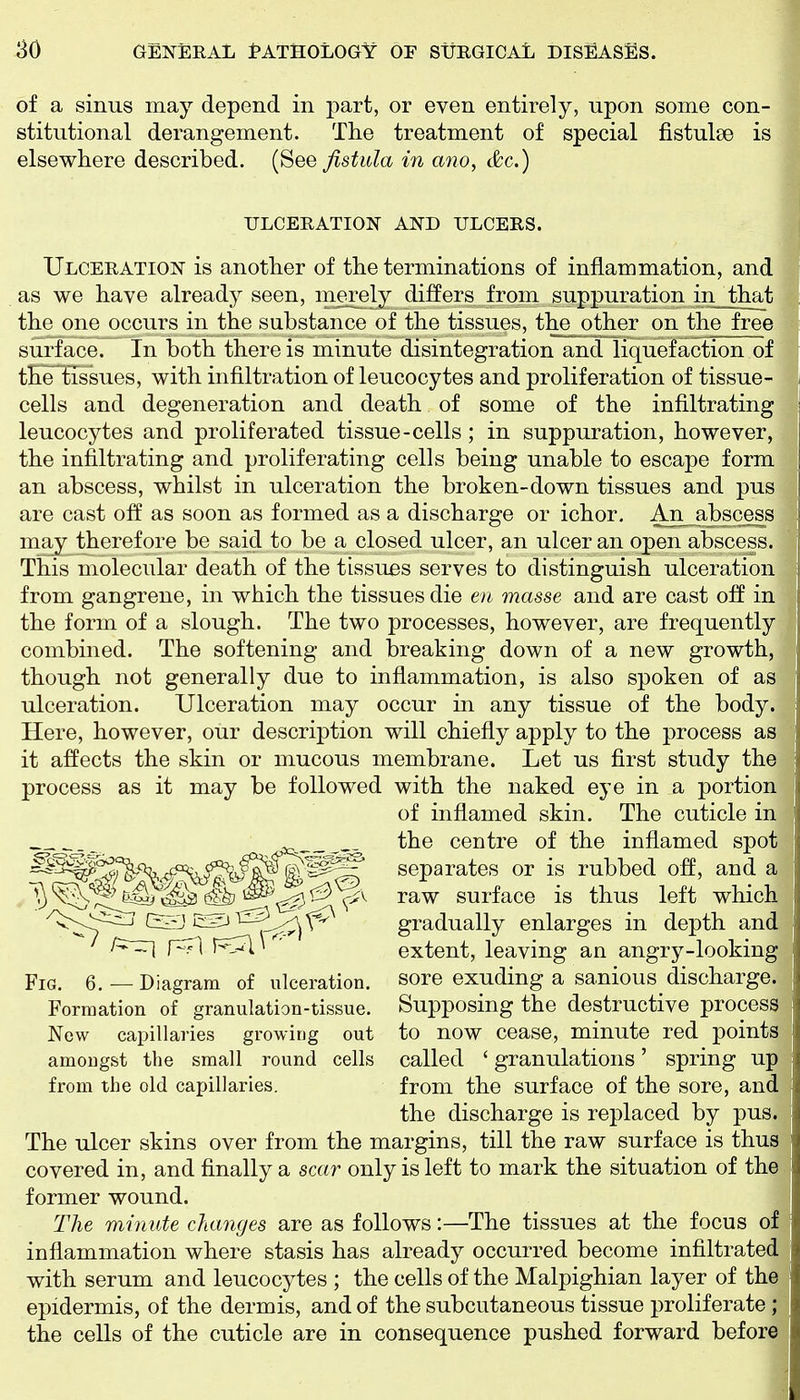 of a sinus may depend in part, or even entirely, upon some con- stitutional derangement. The treatment of special fistulse is elsewhere described. (See fistula in ano, &c.) ULCERATION AND ULCERS. Ulceration is another of the terminations of inflammation, and as we have already seen, merely differs from suppuration in that the one occurs in the substance of the tissues, the other on the free surface. In both there is minute disintegration and liquefaction of the tissues, with infiltration of leucocytes and proliferation of tissue- cells and degeneration and death of some of the infiltrating leucocytes and proliferated tissue-cells; in suppuration, however, the infiltrating and proliferating cells being unable to escape form an abscess, whilst in ulceration the broken-down tissues and pus are cast off as soon as formed as a discharge or ichor. Aii abscess may therefore be said to be a closed ulcer, an ulcer an open abscess. This molecular death of the tissues serves to distinguish ulceration from gangrene, in which the tissues die en masse and are cast off in the form of a slough. The two processes, however, are frequently combined. The softening and breaking down of a new growth, though not generally due to inflammation, is also spoken of as ulceration. Ulceration may occur in any tissue of the body. Here, however, our description will chiefly apply to the process as it affects the skin or mucous membrane. Let us first study the process as it may be followed with the naked eye in a portion of inflamed skin. The cuticle in the centre of the inflamed spot separates or is rubbed off, and a raw surface is thus left which gradually enlarges in depth and extent, leaving an angry-looking sore exuding a sanious discharge. Supposing the destructive process to now cease, minute red points called ' granulations ' spring up from the surface of the sore, and the discharge is replaced by pus. The ulcer skins over from the margins, till the raw surface is thus covered in, and finally a scar only is left to mark the situation of the former wound. The minute changes are as follows:—The tissues at the focus of inflammation where stasis has already occurred become infiltrated with serum and leucocytes ; the cells of the Malpighian layer of the epidermis, of the dermis, and of the subcutaneous tissue proliferate ; the cells of the cuticle are in consequence pushed forward before Fig. 6. ■— Diagram of ulceration. Formation of granulation-tissue. New capillaries growing out amongst the small round cells from the old capillaries.