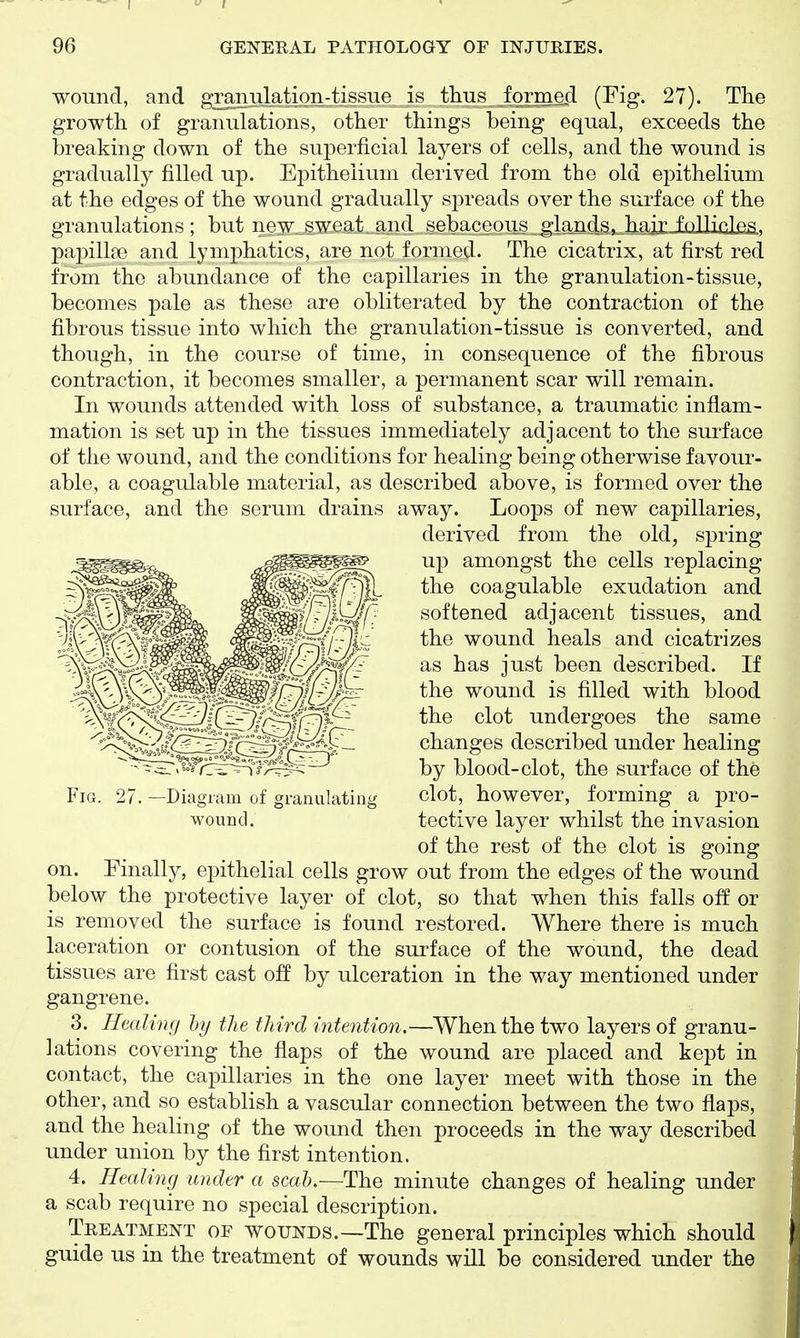 wound, and gr^iulation^tissue is thus forme.d (Fig. 27). The growth of granulations, other things being equal, exceeds the breaking down of the superficial layers of cells, and the wound is gradually filled up. Epithelium derived from the old epithelium at the edges of the wound gradually spreads over the surface of the granulations; but new. sweat ^J^^^ sebnneons P-lnnrlsj hnir fo1b'p.]ft.c; papillae and lymphatics, are not formed. The cicatrix, at first red from the abundance of the capillaries in the granulation-tissue, becomes pale as these are obliterated by the contraction of the fibrous tissue into which the granulation-tissue is converted, and though, in the course of time, in consequence of the fibrous contraction, it becomes smaller, a permanent scar will remain. In wounds attended with loss of substance, a traumatic inflam- mation is set up in the tissues immediately adjacent to the surface of the wound, and the conditions for healing being otherwise favour- able, a coagulable material, as described above, is formed over the surface, and the serum drains away. Loops of new capillaries, derived from the old, spring up amongst the cells replacing the coagulable exudation and softened adjacent tissues, and the wound heals and cicatrizes as has just been described. If the wound is filled with blood the clot undergoes the same changes described under healing by blood-clot, the surface of the clot, however, forming a pro- tective layer whilst the invasion of the rest of the clot is going on. Finally, epithelial cells grow out from the edges of the wound below the protective layer of clot, so that when this falls off or is removed the surface is found restored. Where there is much laceration or contusion of the surface of the wound, the dead tissues are first cast off by ulceration in the way mentioned under gangrene. 3. Healing hy the third intention.—When the two layers of granu- lations covering the flaps of the wound are placed and kept in contact, the capillaries in the one layer meet with those in the other, and so establish a vascular connection between the two flaps, and the healing of the wound then proceeds in the way described under union by the first intention. 4. Healing under a scat.—The minute changes of healing under a scab require no special description. Treatment of wounds.—The general principles which should guide us in the treatment of wounds will be considered under the