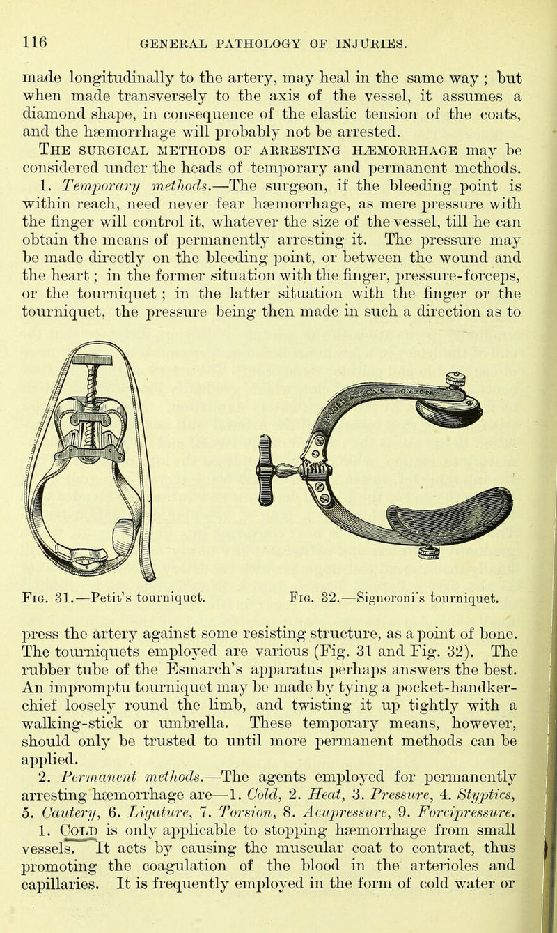 made longitudinally to the artery, may heal in the same way ; but when made transversely to the axis of the vessel, it assumes a diamond shape, in consequence of the elastic tension of the coats, and the haemorrhage will probably not be arrested. The surgical methods of arresting hemorrhage may be considered under the heads of temporary and permanent methods. 1. Temporary methods.—The surgeon, if the bleeding point is within reach, need never fear haemorrhage, as mere pressure with the finger will control it, whatever the size of the vessel, till he can obtain the means of permanently arresting it. The pressure may be made directly on the bleeding point, or between the wound and the heart; in the former situation with the finger, pressure-forceps, or the tourniquet; in the latter situation with the finger or the tourniquet, the pressui'e being then made in such a direction as to press the artery against some resisting structure, as a point of bone. The tourniquets employed are various (Fig. 31 and Fig. 32). The rubber tube of the Esmarch's apparatus perhaps answers the best. An impromptu tourniquet may be made by tying a pocket-handker- chief loosely round the limb, and twisting it up tightly with a walking-stick or umbrella. These temporary means, however, should only be trusted to until more j^ermanent methods can be applied. 2. Permcment methods.—The agents employed for permanently arresting haemorrhage are—1. Cold, 2. Heat, 3. Pressure, 4. Styptics, o. Cautery, 6. Ligature, 7. Torsion, 8. Acupressure, 9. Forcipressure. 1. Cold is only applicable to stopping haemorrhage from small vesselsT It acts by causing the muscular coat to contract, thus promoting the coagulation of the blood in the arterioles and capillaries. It is frequently employed in the form of cold water or Fig. 31.—Petit's tourniquet. Fig. 32.—Signoroni's tourniquet.