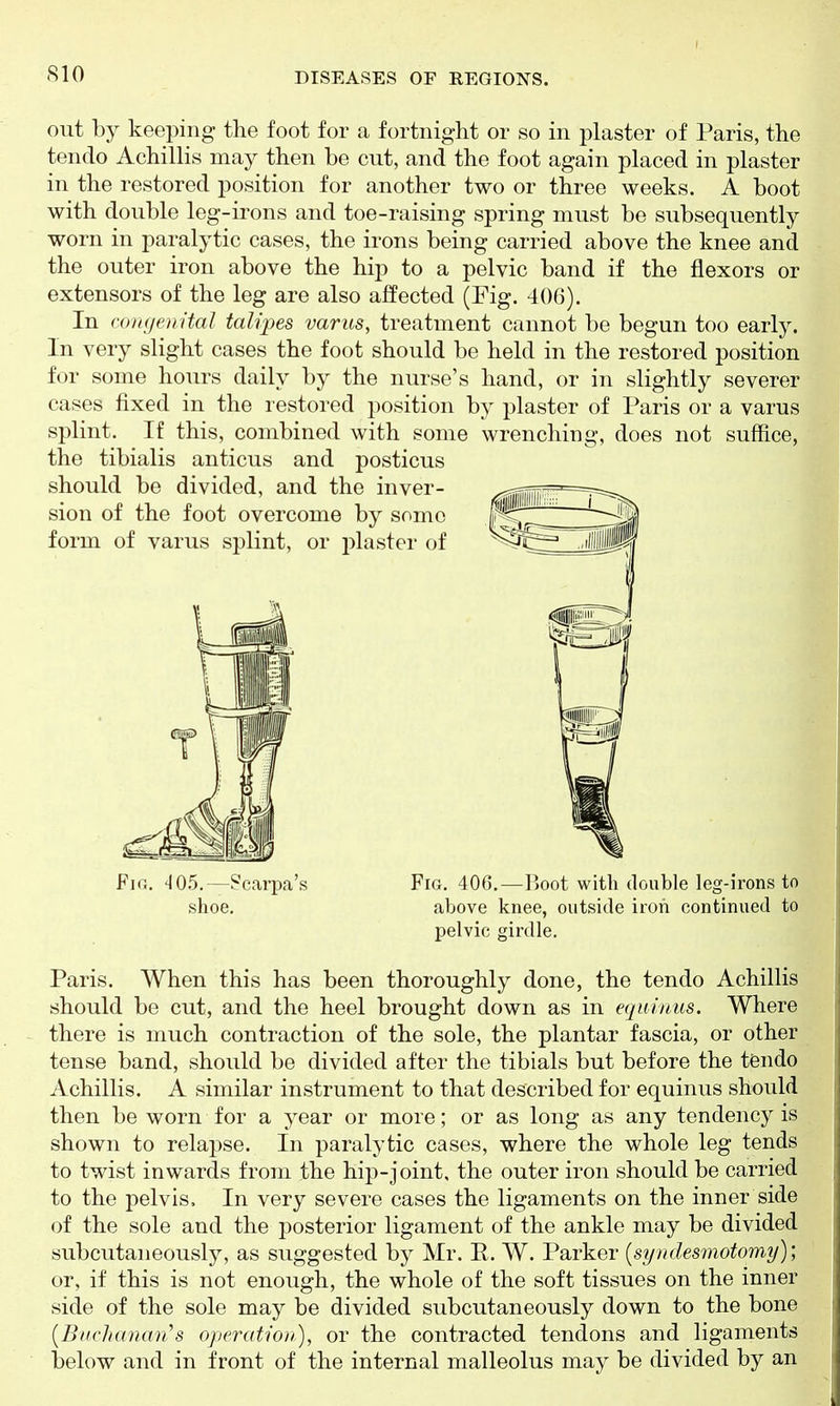 out by keeping the foot for a fortnight or so in plaster of Paris, the tendo Achillis may then be cut, and the foot again placed in plaster in the restored position for another two or three weeks. A boot with double leg-irons and toe-raising spring must be subsequently worn in paralytic cases, the irons being carried above the knee and the outer iron above the hip to a pelvic band if the flexors or extensors of the leg are also affected (Fig. 406). In congenital talipes varus, treatment cannot be begun too early. In very slight cases the foot should be held in the restored position for some hours daily by the nurse's hand, or in slightly severer cases fixed in the restored position by plaster of Paris or a varus splint. If this, combined with some wrenching, does not suffice, the tibialis anticus and posticus Fig. 405.—?carj)a's Fia. 406.—Boot with double leg-irons to shoe. above knee, outside iron continued to pelvic girdle. Paris. When this has been thoroughly done, the tendo Achillis should be cut, and the heel brought down as in equinus. Where there is much contraction of the sole, the plantar fascia, or other tense band, should be divided after the tibials but before the tfendo Achillis. A similar instrument to that described for equinus should then be worn for a year or more; or as long as any tendency is shown to relapse. In paralytic cases, where the whole leg tends to twist inwards from the hip-joint, the outer iron should be carried to the pelvis. In very severe cases the ligaments on the inner side of the sole and the posterior ligament of the ankle may be divided subcutaneously, as suggested by Mr. R. W. Parker [syndesmotomy); or, if this is not enough, the whole of the soft tissues on the inner side of the sole may be divided subcutaneously down to the bone (BncJuman's operation), or the contracted tendons and ligaments IdcIow and in front of the internal malleolus may be divided by an