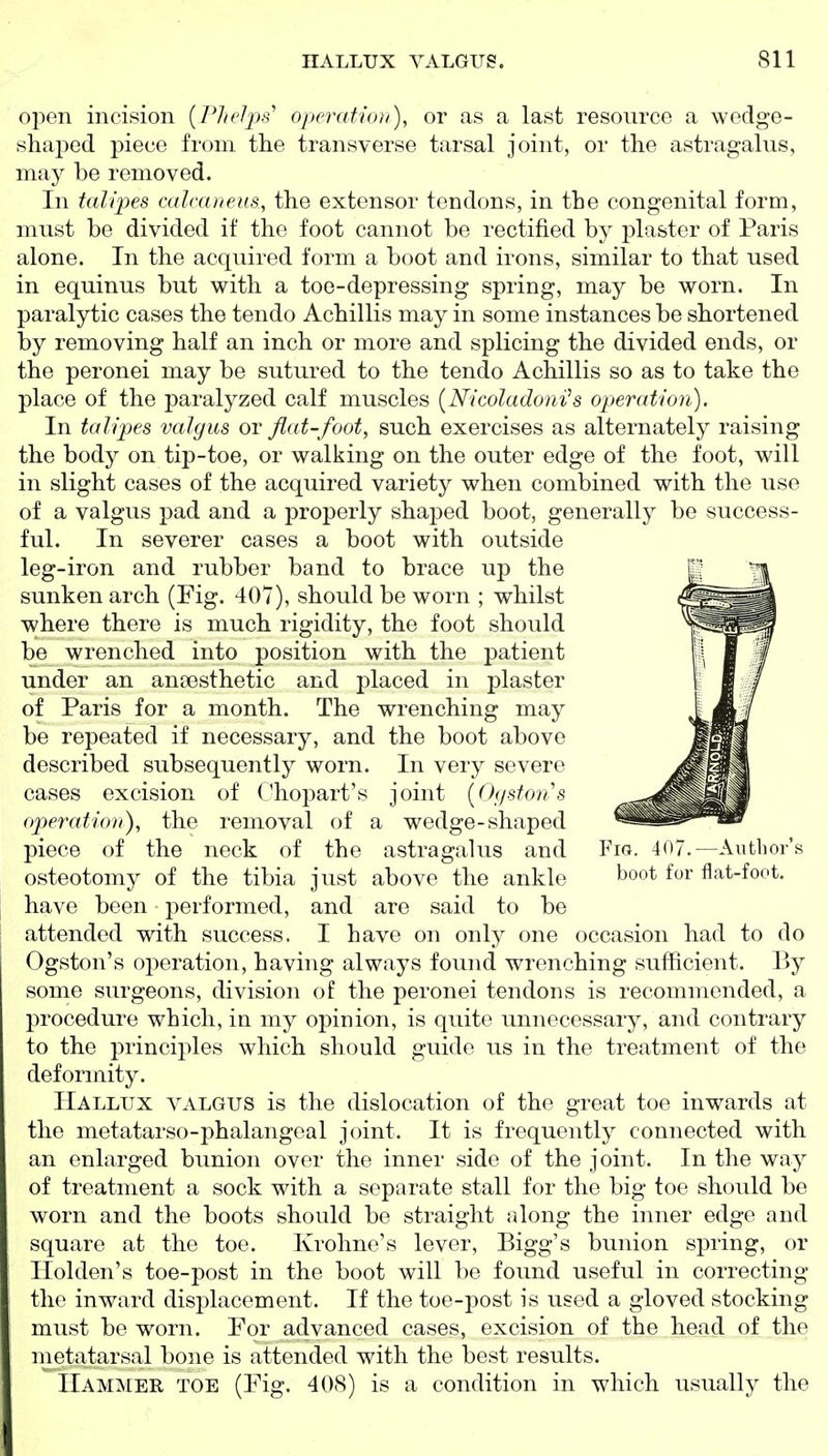 open incision {PheJps' operation), or as a last resource a wedge- shajDcd piece from the transverse tarsal joint, or the astragalus, may be removed. In talipes calcaneus, the extensor tendons, in the congenital form, must be divided if the foot cannot be rectified by plaster of Paris alone. In the acquired form a boot and irons, similar to that used in equinus but with a toe-depressing spring, may be worn. In paralytic cases the tendo Achillis may in some instances be shortened by removing half an inch or more and splicing the divided ends, or the peronei may be sutured to the tendo Achillis so as to take the place of the paralyzed calf muscles [Nicoladoni^s operation). In talipes valgus or fiat-foot, such exercises as alternately raising the body on tip-toe, or walking on the outer edge of the foot, will in slight cases of the acquired variety when combined with the use of a valgus pad and a properly shaped boot, generally be success- ful. In severer cases a boot with outside leg-iron and rubber band to brace up the sunken arch (Fig. 407), should be worn ; whilst where there is much rigidity, the foot should be wrenched into position with the patient under an anaesthetic and placed in plaster of Paris for a month. The wrenching may be repeated if necessary, and the boot above described subsequently worn. In very severe cases excision of Chopart's joint [Oystons op>erati(m), the removal of a wedge-shaped piece of the neck of the astragalus and Fig. 4()7.—Author's osteotomy of the tibia just above the ankle '^o^t for flat-foot, have been performed, and are said to be attended with success. I have on only one occasion had to do Ogston's operation, having always found wrenching sufficient. By some surgeons, division of the peronei tendons is recommended, a procedure which, in my opinion, is quite unnecessary, and contrary to the j)rinciples which should guide us in the treatment of the deformity. Hallux valgus is the dislocation of the great toe inwards at the metatarso-phalangeal joint. It is frequently connected with an enlarged bunion over the inner side of the joint. In the way of treatment a sock with a separate stall for the big toe should be worn and the boots should be straight tjlong the inner edge and square at the toe. Krohne's lever, Bigg's bunion spring, or Ilolden's toe-post in the boot will be found useful in correcting the inward disiDlacement. If the toe-j^ost is used a gloved stocking must be worn. For advanced cases, excision of the head of the metatarsal bone is attended with the best results. IIam:\ieii toe (Fig. 408) is a condition in which usually the