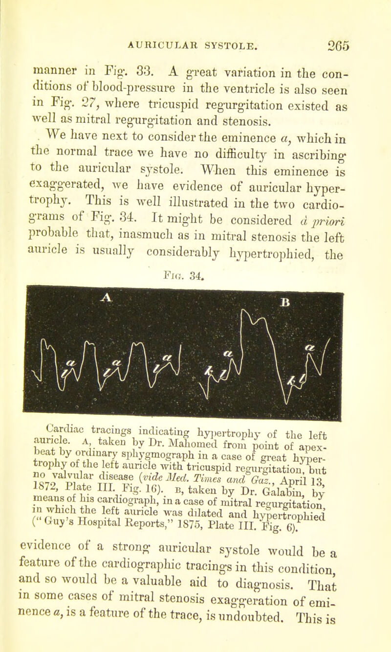 manner in Fig-. 33. A great variation in the con- ditions of blood-pressure in the ventricle is also seen in Fig. 27, where tricuspid regurgitation existed as well as mitral regurgitation and stenosis. We have next to consider the eminence a, which in the normal trace we have no difficulty in ascribing- to the auricular systole; When this eminence is exaggerated, we have evidence of auricular hyper- trophy. This is well illustrated in the two cardio- grams of Fig. 34. It might be considered d priori probable that, inasmuch as in mitral stenosis the left auricle is usually considerably hypertrophied, the Fig. 34. Mriri? a t.l 8 i m^1Ca*1rnf ^'trophy of the left auricle. A taken by Dr. Mahomed from point of apex- beat by ordinary sphygmograph in a case of great hyper- trophy of the eft auricle with tricuspid regurgitation^ ?872 Hat mT ^Med-^ «<flE. April I? Ib72, Plate III. Fig. 16). b, taken by Dr. Galabin, bv means of his cardiograph, in a case of mitral regurgitation in which the left auricle was dilated and hy^eiSphTed (' Guy's Hospital Reports, 1875, Plate III. Fig. 6). evidence of a strong auricular systole would be a feature of the cardiography tracings in this condition and so would be a valuable aid to diagnosis. That in some cases of mitral stenosis exaggeration of emi- nence a, is a feature of the trace, is undoubted. This is