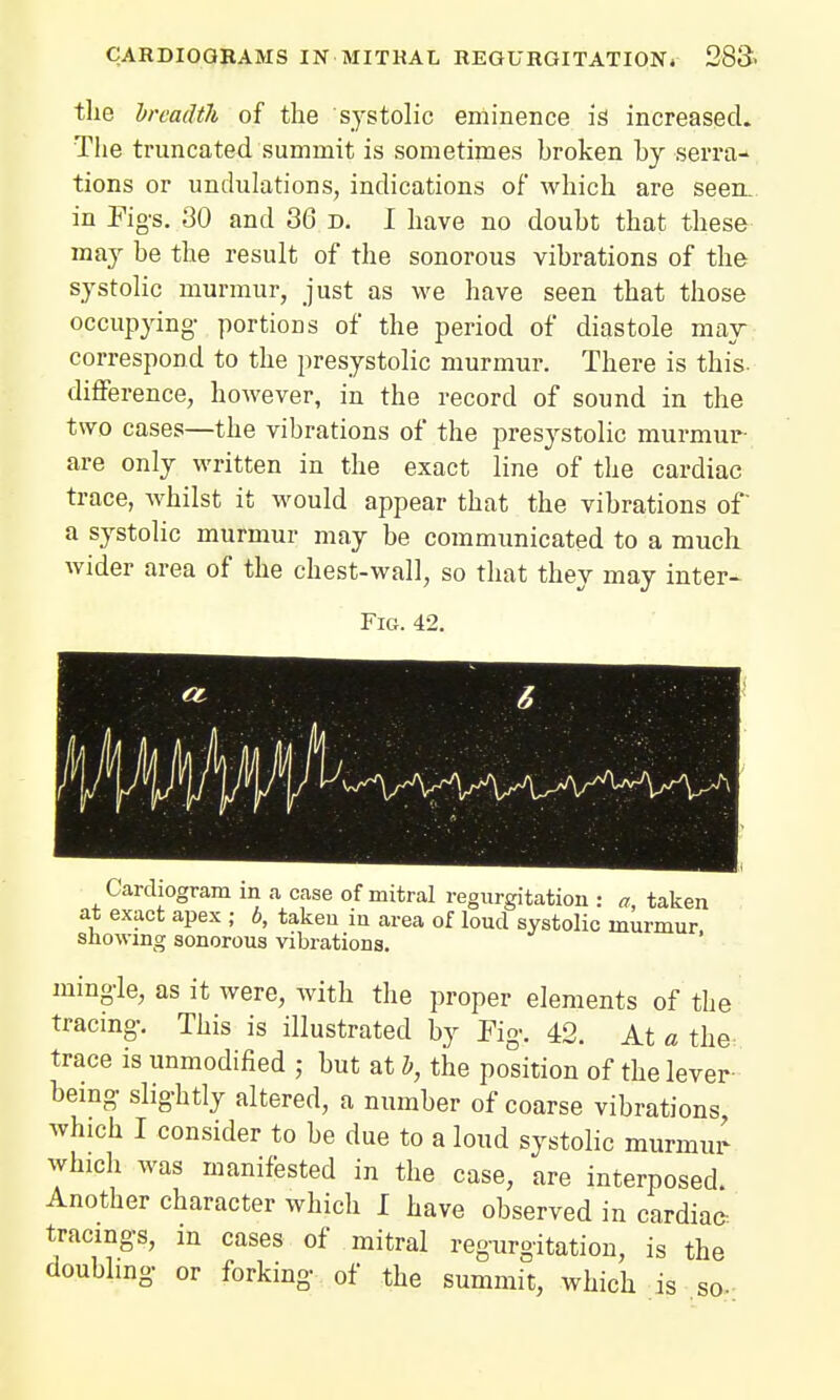 the breadth of the 'systolic eminence is increased. The truncated summit is sometimes broken by serra- tions or undulations, indications of which are seem in Figs. 30 and 36 d. I have no doubt that these may be the result of the sonorous vibrations of the systolic murmur, just as we have seen that those occupying- portions of the period of diastole may- correspond to the presystolic murmur. There is this- difference, however, in the record of sound in the two cases—the vibrations of the presystolic murmur- are only written in the exact line of the cardiac trace, whilst it would appear that the vibrations of a systolic murmur may be communicated to a much wider area of the chest-wall, so that they may inter- Fig. 42. Cardiogram in a case of mitral regurgitation : a, taken at exact apex ; b, taken in area of loud systolic murmur showing sonorous vibrations. mingle, as it were, with the proper elements of the tracing. This is illustrated by Pig. 42. At a the: trace is unmodified ; but at b, the position of the lever being slightly altered, a number of coarse vibrations, which I consider to be due to a loud systolic murium' which was manifested in the case, are interposed. Another character which I have observed in cardiac tracings, m cases of mitral regurgitation, is the doubling or forking of the summit, which is so-