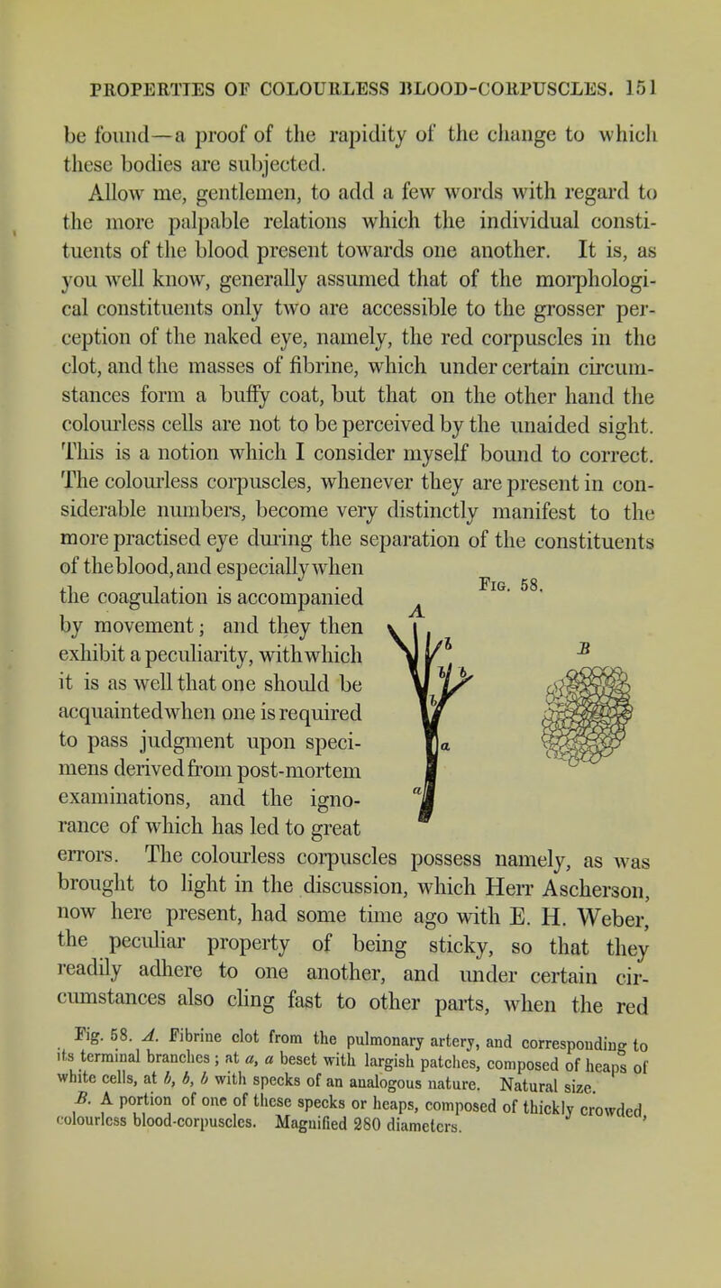 be found—a proof of the rapidity of the change to which these bodies are subjected. Allow me, gentlemen, to add a few words with regard to the more palpable relations which the individual consti- tuents of the blood present towards one another. It is, as you well know, generally assumed that of the morphologi- cal constituents only two are accessible to the grosser per- ception of the naked eye, namely, the red corpuscles in the clot, and the masses of fibrine, which under certain circum- stances form a butiy coat, but that on the other hand the colourless cells are not to be perceived by the unaided sight. This is a notion which I consider myself bound to correct. The colourless corpuscles, whenever they are present in con- siderable numbers, become very distinctly manifest to the more practised eye during the separation of the constituents of the blood, and especially when the coagulation is accompanied by movement; and they then exhibit a peculiarity, with which it is as well that one should be acquaintedwhen one is required to pass judgment upon speci- mens derived from post-mortem examinations, and the igno- rance of which has led to great errors. The colourless corpuscles possess namely, as was brought to light in the discussion, which Herr Ascherson, now here present, had some time ago with E. H. Weber, the peculiar' property of being sticky, so that they readily adhere to one another, and under certain cir- cumstances also cling fast to other parts, when the red Fig. 58. Ä. Fibrine clot from the pulmonary arterj, and corresponding to its terminal branches ; at a, a beset with largish patches, composed of heaps of white cells, at b, b, b with specks of an analogous nature. Natural size B. A portion of one of these specks or heaps, composed of thickly crowded colourless blood-corpuscles. Magnified 280 diameters.