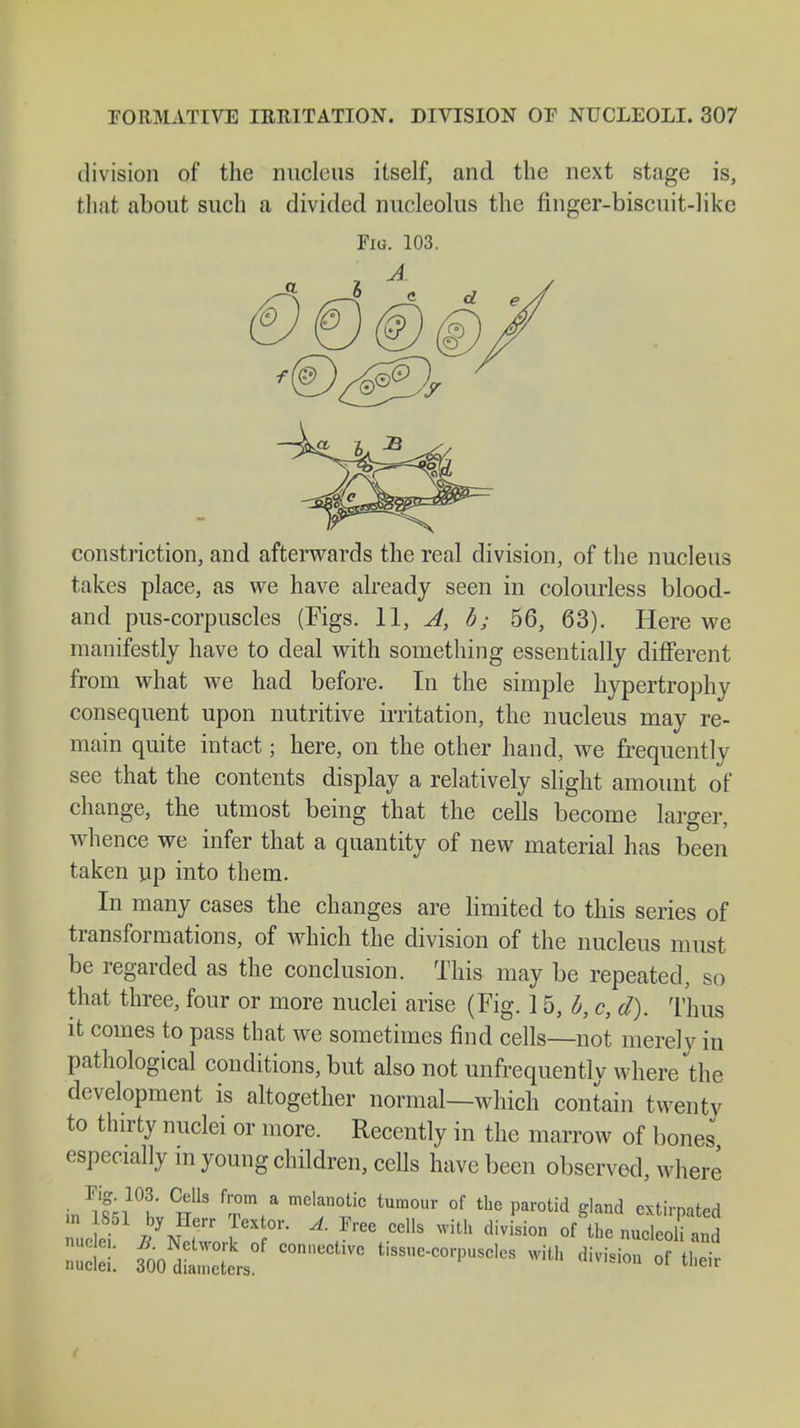 division of the nucleus itself, and the next stage is, that about such a divided nucleolus the finger-biscuit-like Fig. 103. constriction, and afterwards the real division, of the nucleus takes place, as we have already seen in colourless blood- and pus-corpuscles (Figs. 11, A, b; 56, 63). Here we manifestly have to deal with something essentially different from what we had before. In the simple hypertrophy consequent upon nutritive irritation, the nucleus may re- main quite intact; here, on the other hand, we frequently see that the contents display a relatively slight amount of change, the utmost being that the cells become larger, whence we infer that a quantity of new material has been taken up into them. In many cases the changes are limited to this series of transformations, of which the division of the nucleus must be regarded as the conclusion. This may be repeated, so that three, four or more nuclei arise (Fig. 15, b, c, d). Thus it comes to pass that we sometimes find cells—not merely in pathological conditions, but also not unfrequentlv where the development is altogether normal—which contain twenty to thirty nuclei or more. Recently in the marrow of bones especially m young children, cells have been observed, where • ^f;,10^ CTeTUs fr°m(a melanotic tumoiir of Parotid gland extirpated LS TT A rreC CCllS WiÜ1 divi8i0n °f -nucleol and St fio5JSL81 COmieCtlVC *h di™ of their