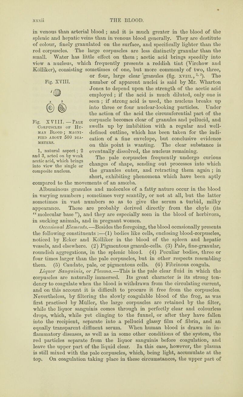 in venous than arterial blood ; and it is much greater in the blood of the splenic and hepatic veins than in venous blood generally. They are destitute of colour, finely granulated on the surface, and specifically lighter than the red corpuscles. The large corpuscles are less distinctly granular than the small. Water has little effect on them ; acetic acid brings speedily into view a nucleus, which frequently presents a reddish tint (Virchow and Kolliker), consisting sometimes of one, but more commonly of two, three, or four, large clear ^granules (fig. xviii.,2’3). The number of apparent nuclei is said by Mr. Wharton Jones to depend upon the strength of the acetic acid employed ; if the acid is much diluted, only one is seen ; if strong acid is used, the nucleus breaks up into three or four nuclear-looking particles. Under the action of the acid the circumferential part of the corpuscle becomes clear of granules and pellucid, and swells up by imbibition with a regular and well- defined outline, which has been taken for the indi¬ cation of a fine envelope, but conclusive evidence on this point is wanting. The clear substance is eventually dissolved, the nucleus remaining. The pale corpuscles frequently undergo curious changes of shape, sending out processes into which the granules enter, and retracting them again; in short, exhibiting phenomena which have been aptly compared to the movements of an amoeba. Albuminous granules and molecules of a fatty nature occur in the blood in varying numbers ; sometimes very scantily, or not at all, but the latter sometimes in vast numbers so as to give the serum a turbid, milky appearance. These are probably derived directly from the chyle (its “molecular base ”), and they are especially seen in the blood of herbivora, in sucking animals, and in pregnant women. Occasional Elements.—Besides the foregoing, the blood occasionally presents the following constituents :—(1) bodies like cells, enclosing blood-corpuscles, noticed by Ecker and Kolliker in the blood of the spleen and hepatic vessels, and elsewhere. (2) Pigmentous granule-cells. (3) Pale, fine-granular, roundish aggregations, in the splenic blood. (4) Peculiar bodies, three or four times larger than the pale corpuscles, but in other respects resembling them. (5) Caudate, pale, or pigmentous cells. (6) Fibrinous coagula. Liquor Sanguinis, or Plasma.—This is the pale clear fluid in which the corpuscles are naturally immersed. Its great character is its strong ten¬ dency to coagulate when the blood is withdrawn from the circulating current, and on this account it is difficult to procure it free from the corpuscles. Nevertheless, by filtering the slowly coagulable blood of the frog, as was first practised by Muller, the large corpuscles are retained by the filter, while the liquor sanguinis comes through in perfectly clear and colourless drops, which, while yet clinging to the funnel, or after they have fallen into the recipient, separate into a pellucid glassy film of fibrin, and an equally transparent diffluent serum. When human blood is drawn in in¬ flammatory diseases, as well as in some other conditions of the system, the red particles separate from the liquor sanguinis before coagulation, and leave the upper part of the liquid clear. In this case, however, the plasma is still mixed with the pale corpuscles, which, being light, accumulate at the top. On coagulation taking place in these circumstances, the upper part of Fig. XVIII. Fig. XVIII.—Pale Corpuscles op Hu¬ man Blood ; magni¬ fied ABOUT 500 DIA¬ METERS. 1, natural aspect; 2 and 3, acted on by weak acetic acid, which, brings into view the single or composite nucleus.