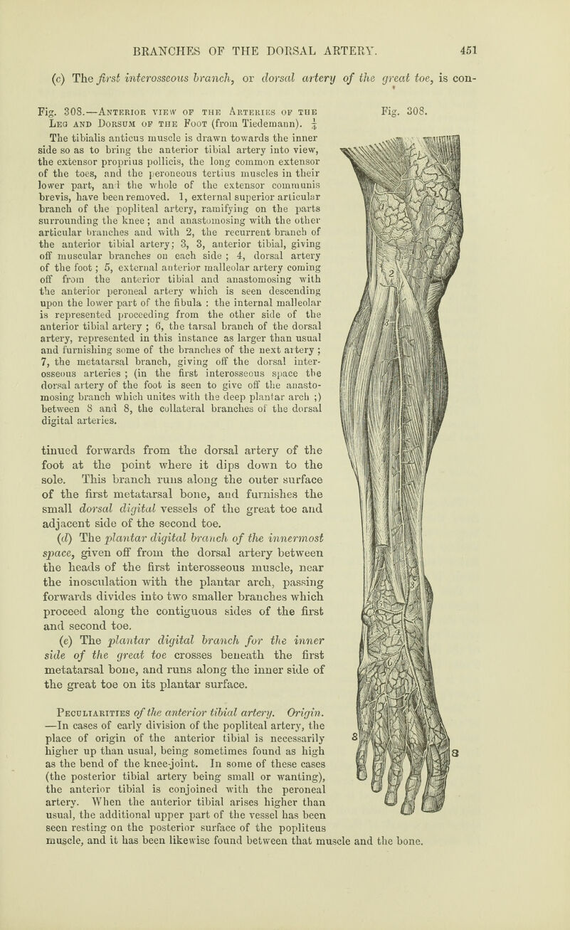 (c) The first interosseous branch, or dorsal artery of the great toe, is con- Fig. 308.—Anterior view of the Arteries of the Fig. 308. Leo and Dorsum of the Foot (from Tiedemann). ^ The tibialis anticus muscle is drawn towards the inner side so as to bring the anterior tibial artery into view, the extensor proprius pollicis, the long common extensor of the toes, and the peroneous tertius muscles in their lower part, and the whole of the extensor communis brevis, have been removed. 1, external superior articular branch of the popliteal artery, ramifying on the parts surrounding the knee ; and anastomosing with the other articular branches and with 2, the recurrent branch of the anterior tibial artery; 3, 3, anterior tibial, giving off muscular branches on each side ; 4, dorsal artery of the foot; 5, external anterior malleolar artery coming off from the anterior tibial and anastomosing with the anterior peroneal artery which is seen descending upon the lower part of the fibula : the internal malleolar is represented proceeding from the other side of the anterior tibial artery ; 6, the tarsal branch of the dorsal artery, represented in this instance as larger than usual and furnishing some of the branches of the next artery ; 7, the metatarsal branch, giving off the dorsal inter' osseous arteries ; (in the first interosseous space the dorsal artery of the foot is seen to give off the anasto¬ mosing branch which unites with the deep plantar arcb ;) between 8 and 8, the collateral branches of the dorsal digital arteries. tinued forwards from the dorsal artery of the H'lKlI foot at the point where it dips down to the sole. This branch runs along the outer surface of the first metatarsal bone, and furnishes the small dorsal digital vessels of the great toe and adjacent side of the second toe. (d) The plantar digital branch of the innermost space, given off from the dorsal artery between the heads of the first interosseous muscle, near the inosculation with the plantar arch, passing forwards divides into two smaller branches which proceed along the contiguous sides of the first and second toe. (e) The plantar digital branch for the inner side of the great toe crosses beneath the first metatarsal bone, and runs along the inner side of the great toe on its plantar surface. Peculiarities of the anterior tibial artery. Origin. —In cases of early division of the popliteal artery, the place of origin of the anterior tibial is necessarily 8j| higher up than usual, being sometimes found as high as the bend of the knee-joint. In some of these cases (the posterior tibial artery being small or wanting), the anterior tibial is conjoined with the peroneal artery. When the anterior tibial arises higher than usual, the additional upper part of the vessel has been seen resting on the posterior surface of the popliteus muscle, and it has been likewise found between that muscle and the bone.