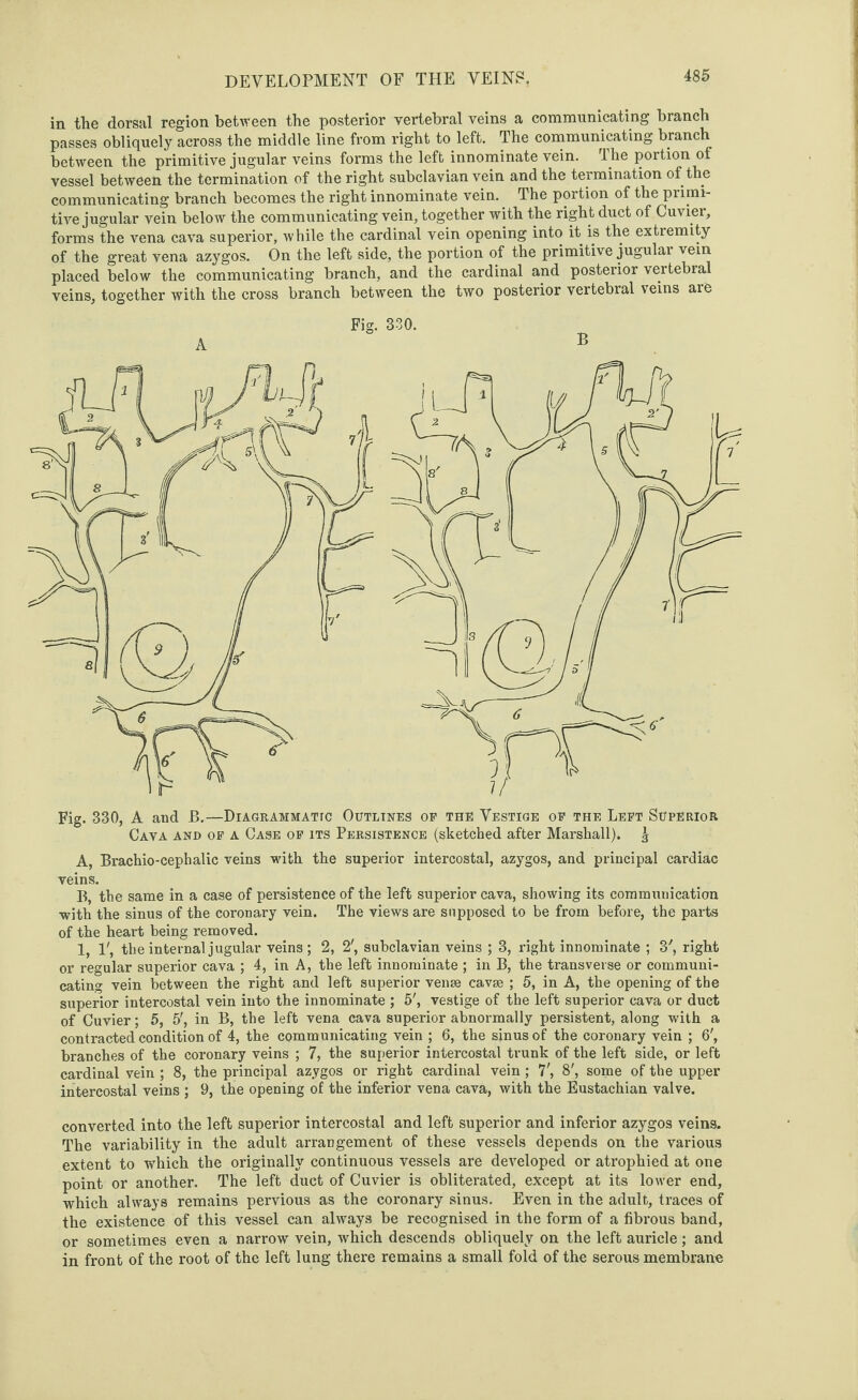 in the dorsal region between the posterior vertebral veins a communicating branch passes obliquely across the middle line from right to left. The communicating branch between the primitive jugular veins forms the left innominate vein. The portion of vessel between the termination of the right subclavian vein and the termination of the communicating branch becomes the right innominate vein. The portion of the primi¬ tive jugular vein below the communicating vein, together with the right duct of Cuvier, forms the vena cava superior, while the cardinal vein opening into it is the extremity of the great vena azygos. On the left side, the portion of the primitive jugular vein placed below the communicating branch, and the cardinal and posterior vertebral veins, together with the cross branch between the two posterior vertebral veins are Fig. 330. A Fig. 330, A and B.—Diagrammatic Outlines of the Vestige of the Left Superior Cava and of a Case of its Persistence (sketched after Marshall). ^ A, Brachio-cephalic veins -with the superior intercostal, azygos, and principal cardiac veins. B, the same in a case of persistence of the left superior cava, showing its communication with the sinus of the coronary vein. The views are supposed to be from before, the parts of the heart being removed. 1, 1', the internal jugular veins; 2, 2', subclavian veins ; 3, right innominate ; 3', right or regular superior cava ; 4, in A, the left innominate ; in B, the transverse or communi¬ cating vein between the right and left superior vense cavse ; 5, in A, the opening of the superior intercostal vein into the innominate ; 5', vestige of the left superior cava or duct of Cuvier; 5, 5', in B, the left vena cava superior abnormally persistent, along with a contracted condition of 4, the communicating vein ; 6, the sinus of the coronary vein ; 6', branches of the coronary veins ; 7, the superior intercostal trunk of the left side, or left cardinal vein ; 8, the principal azygos or right cardinal vein ; 7', 8', some of the upper intercostal veins ; 9, the opening of the inferior vena cava, with the Eustachian valve. converted into the left superior intercostal and left superior and inferior azygos veins. The variability in the adult arrangement of these vessels depends on the various extent to which the originally continuous vessels are developed or atrophied at one point or another. The left duct of Cuvier is obliterated, except at its lower end, which always remains pervious as the coronary sinus. Even in the adult, traces of the existence of this vessel can always be recognised in the form of a fibrous band, or sometimes even a narrow vein, which descends obliquely on the left auricle; and in front of the root of the left lung there remains a small fold of the serous membrane