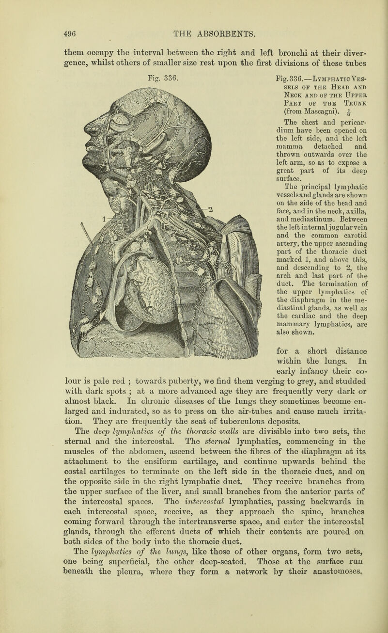 them occupy the interval between the right and left bronchi at their diver¬ gence, whilst others of smaller size rest upon the first divisions of these tubes for a short distance within the lungs. In early infancy their co¬ lour is pale red ; towards puberty, we find them verging to grey, and studded with dark spots ; at a more advanced age they are frequently very dark or almost black. In chronic diseases of the lungs they sometimes become en¬ larged and indurated, so as to press on the air-tubes and cause much irrita¬ tion. They are frequently the seat of tuberculous deposits. The deep lymphatics of the thoracic v;alls are divisible into two sets, the sternal and the intercostal. The sternal lymphatics, commencing in the muscles of the abdomen, ascend between the fibres of the diaphragm at its attachment to the ensiform cartilage, and continue upwards behind the costal cartilages to terminate on the left side in the thoracic duct, and on the opposite side in the right lymphatic duct. They receive branches from the upper surface of the liver, and small branches from the anterior parts of the intercostal spaces. The intercostal lymphatics, passing backwards in each intercostal space, receive, as they approach the spine, branches coming forward through the interfcransverse space, and enter the intercostal glands, through the efferent ducts of which their contents are poured on both sides of the body into the thoracic duct. The lymphatics of the lungs, like those of other organs, form two sets, one being superficial, the other deep-seated. Those at the surface run beneath the pleura, where they form a network by their anastomoses. Fig. 336. Fig. 336.—Lymphatic Ves¬ sels op the Head and Neck and of the Upper Part op the Trunk (from Mascagni), a The chest and pericar¬ dium have been opened on the left side, and the left mamma detached and thrown outwards over the left arm, so as to expose a great part of its deep surface. The principal lymphatic vesselsand glands are shown on the side of the head and face, and in the neck, axilla, and mediastinum. Between the left internal jugular vein and the common carotid artery, the upper ascending part of the thoracic duct marked 1, and above this, and descending to 2, the arch and last part of the duct. The termination of the upper lymphatics of the diaphragm in the me¬ diastinal glands, as well as the cardiac and the deep mammary lymphatics, are also shown.
