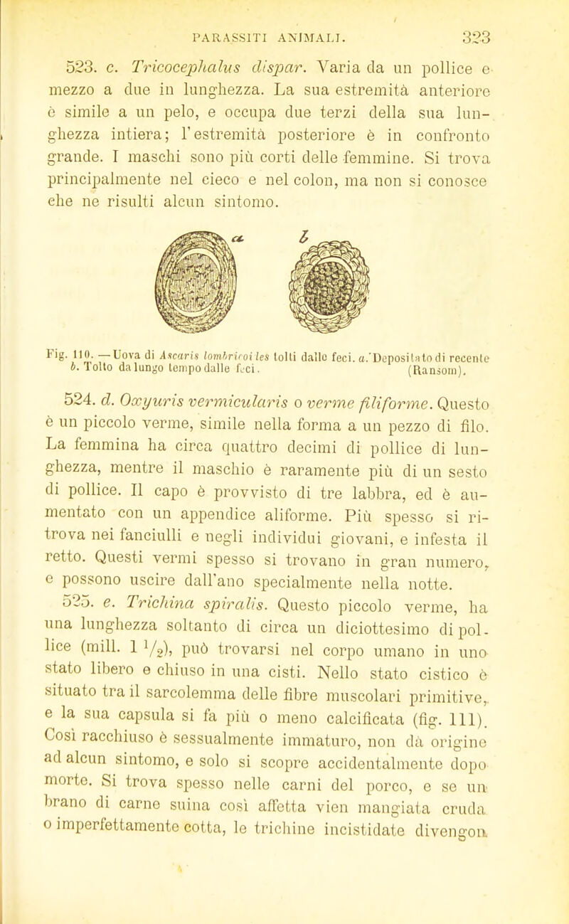 523. c. Tricocephalus clispar. Varia da un pollice e mezzo a due in lunghezza. La sua estremità anteriore ò simile a un pelo, e occupa due terzi della sua lun- ghezza intiera; l'estremità posteriore è in confronto grande. I maschi sono più corti delle femmine. Si trova principalmente nel cieco e nel colon, ma non si conosce che ne risulti alcun sintomo. Fig. 110. —Uova di Ascaris lombricai les tolti dallo feci. a/Depositato di recente ft. Tolto da lungo tempo dalle feci. (Ransom). 524. d. Oocyuris vermicidarìs o verme filiforme. Questo è un piccolo verme, simile nella forma a un pezzo di filo. La femmina ha circa quattro decimi di pollice di lun- ghezza, mentre il maschio è raramente più di un sesto di pollice. Il capo è provvisto di tre labbra, ed è au- mentato con un appendice aliforme. Più spesso si ri- trova nei fanciulli e negli individui giovani, e infesta il retto. Questi vermi spesso si trovano in gran numero, e possono uscire dall'ano specialmente nella notte. 525. e. Trichina spiralis. Questo piccolo verme, ha una lunghezza soltanto di circa un diciottesimo di pol- lice (mill. 1 i/2), può trovarsi nel corpo umano in una stato libero e chiuso in una cisti. Nello stato cistico è situato trail sarcolemma delle fibre muscolari primitive, e la sua capsula si fa più o meno calcificata (fig. 111). Cosi racchiuso è sessualmente immaturo, non dà origine ad alcun sintomo, e solo si scopre accidentalmente dopo morte. Si trova spesso nelle carni del porco, e se un brano di carne suina così afretta vien mangiala cruda o imperfettamente cotta, le trichine incistidate divens-on