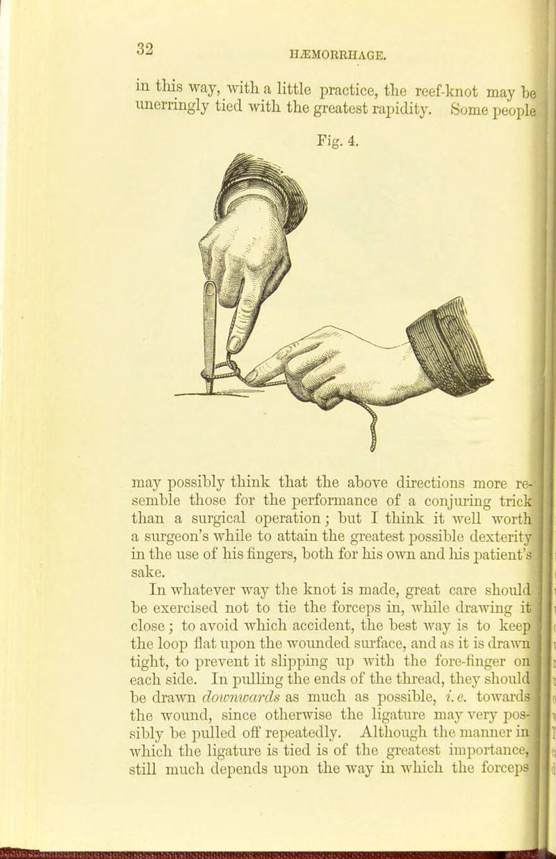 HiEMORRHAGE, may possibly think that the above directions more re- semble those for the performance of a conjuring trick than a surgical operation; but I think it weU worth a surgeon's while to attain the greatest possible dexterity in the use of his fingers, both for his own and liis patient's sake. In whatever way the knot is made, great care should be exercised not to tie the forcejis in, while draAving it close; to avoid which accident, the best way is to keep the loop flat upon the wounded surface, and as it is drawn tight, to prevent it shpping up with the fore-finger on each side. In pulling the ends of the thread, they shoukl he dmwD. dolomvaixls as much as possible, i.e. towaiils | the wound, since otherwise the ligature may very jxis- sibly be pulled off repeatedly. Although the maimer in which the ligature is tied is of the greatest importain r. still much depends upon the way in which the forci i s