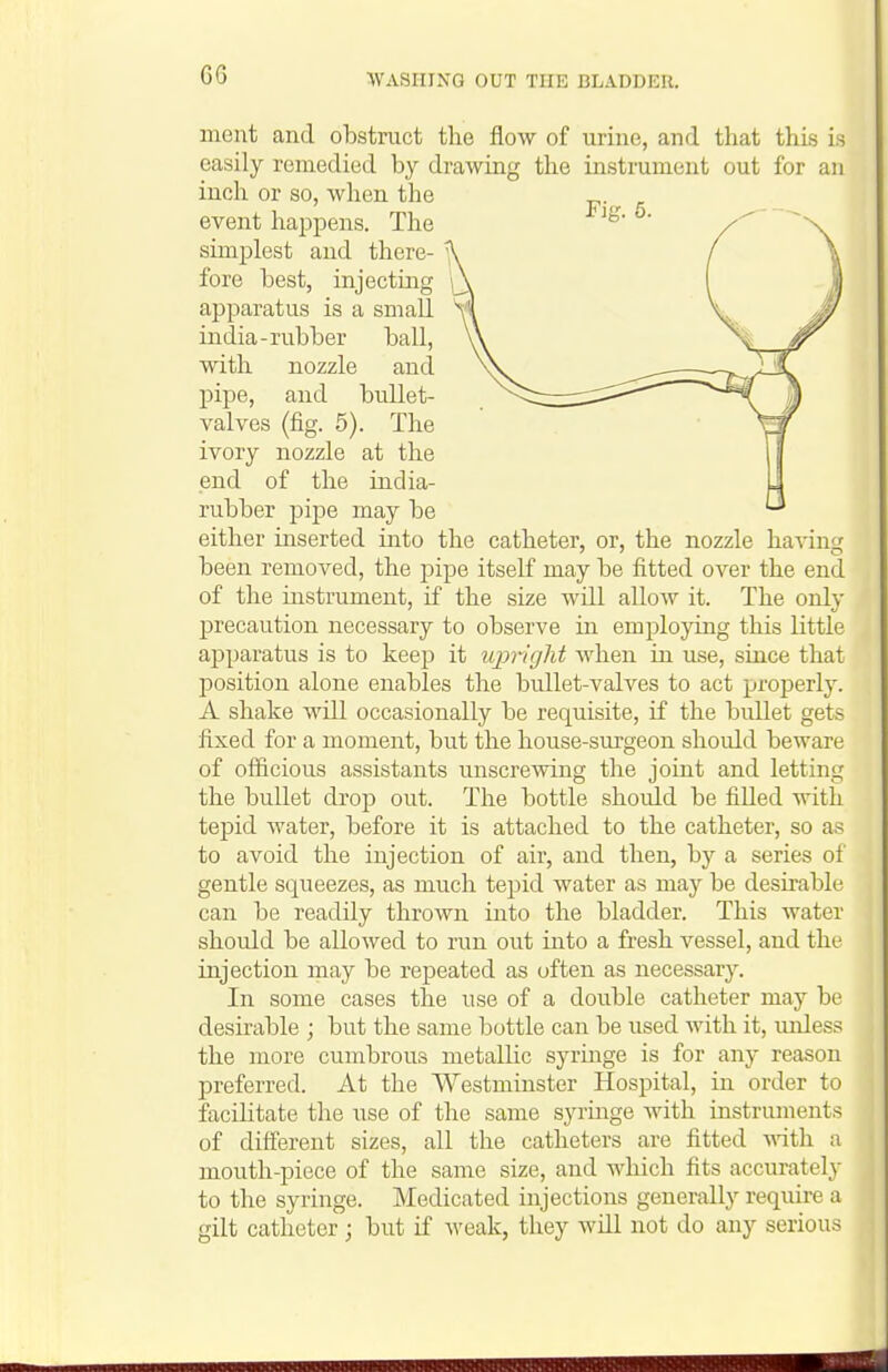 G6 ment and obstruct the flow of urine, and that this is easily remedied by drawing the instrument out for an inch or so, when the event happens. The simplest and there- fore best, injecting apparatus is a small india-rubber ball, with nozzle and pipe, and bullet- valves (fig. 5). The ivory nozzle at the end of the india- rubber pipe may be either inserted into the catheter, or, the nozzle having been removed, the pipe itself may be fitted over the end of the instrument, if the size will allow it. The only jprecaution necessary to observe in employing this little apparatus is to keep it ujmght when in use, since that position alone enables the bullet-valves to act properly. A shake will occasionally be requisite, if the bullet gets fixed for a moment, but the house-surgeon should beware of officious assistants unscrewing the joint and letting the bullet drop out. The bottle should be fiUed with tepid water, before it is attached to the catheter, so anS to avoid the injection of air, and then, by a series of gentle squeezes, as much tepid water as may be desu'able can be readily thrown into the bladder. This water should be allowed to run out into a fresh vessel, and the injection may be repeated as often as necessary. In some cases the use of a double catheter may be desirable ; but the same bottle can be used with it, unless the more cumbrous metallic syringe is for any reason preferred. At the Westminster Hospital, in order to facilitate the use of the same syrmge with instruments of different sizes, all the catheters are fitted ynth. a mouth-piece of the same size, and which fits accurately to the syringe. Medicated injections generally require a gilt catheter; but if Aveak, they wUl not do any serious