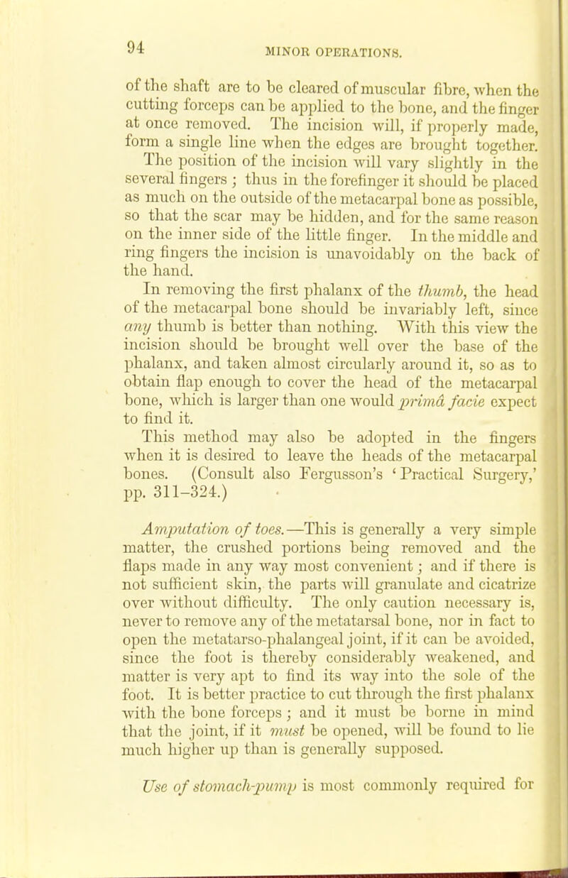 of the shaft are to be cleared of muscular fibre, when the cuttmg forceps can be applied to the bone, and the finger at once removed. The incision will, if properly made, form a single line when the edges are brought together. The position of the incision Avill vary slightly in the several fingers ; thus in the forefinger it sliould be placed as much on the outside of the metacarpal bone as possible, so that the scar may be hidden, and for the same reason on the inner side of the little finger. In the middle and ring fingers the incision is unavoidably on the back of the hand. In removing the first phalanx of the thumb, the head of the metacai'pal bone should be invariably left, since any thumb is better than nothing. With this view the incision should be brought well over the base of the phalanx, and taken almost circularly around it, so as to obtain flap enough to cover the head of the metacarpal bone, which is larger than one would 2'>rimd facie expect to find it. This method may also be adopted in the fingers when it is desired to leave the heads of the metacarpal bones. (Consult also Fergusson's 'Practical Surgery,' pp. 311-324.) Amputation of toes.—This is generally a very simple matter, the crushed portions being removed and the flaps made in any way most convenient; and if there is not sufficient skin, the parts will granulate and cicatrize over without difficulty. The only caution necessary is, never to remove any of the metatarsal bone, nor in fact to open the metatarso-phalangeal joint, if it can be avoided, since the foot is thereby considerably weakened, and matter is very apt to find its way into the sole of the foot. It is better practice to cut through the first phalanx ■with the bone forceps; and it must be borne in mind that the joint, if it must be opened, will be found to lie much higher up than is generally supposed. Use of stomach-pump is most commonly required for
