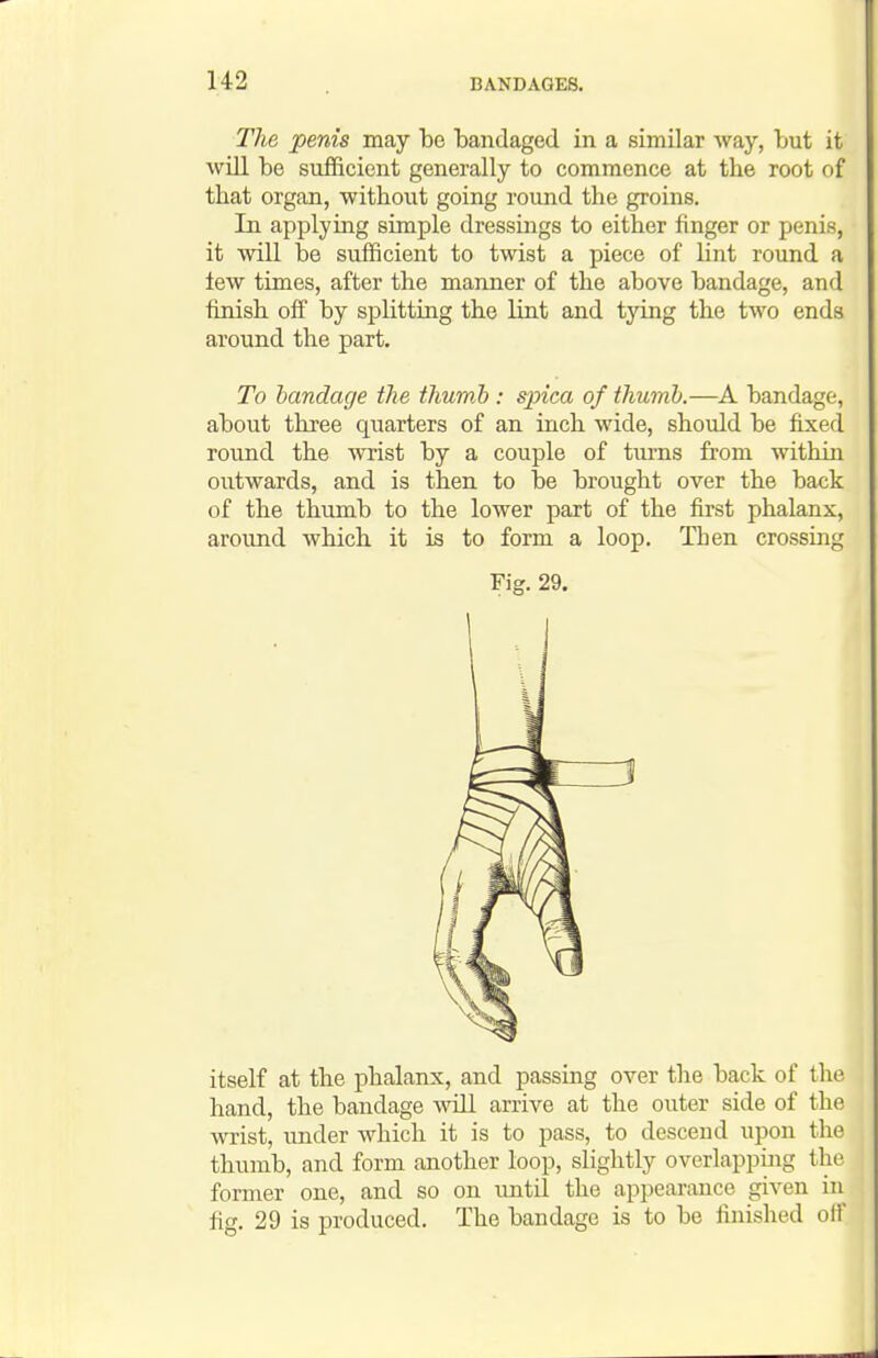 The penis may be bandaged in a similar way, but it will be sufficient generally to commence at the root of that organ, without going round the groins. In applying simple dressings to either finger or penis, it will be sufficient to twist a piece of lint round a lew times, after the manner of the above bandage, and finish off by sphtting the lint and tying the two ends around the part. To bandage the thumb : spica of thumb.—A bandage, about three quarters of an inch wide, should be fixed round the wrist by a couple of tiu-ns from within outwards, and is then to be brought over the back of the thumb to the lower part of the first phalanx, around which it is to form a loop. Then crossing Fig. 29. 1 itself at the phalanx, and passing over the back of the hand, the bandage will arrive at the outer side of the wrist, under which it is to pass, to descend upon the thumb, and form another loop, slightly overlapping the former one, and so on until the appearance given in^ fig. 29 is produced. The bandage is to be finished olf