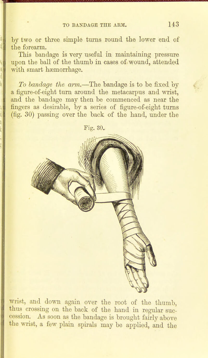 by two or three simple turns round the lower end of the forearm. This bandage is very useful in maintaining pressure upon the ball of the thumb in cases of. wound, attended with smart hsemorrhage. To bandage the arm.—The bandage is to be fixed by a figure-of-eight turn around the metacarpus and wrist, and the bandage may then be conunenced as near the fingers as desii'able, by a series of figure-of-eight turns (fig, 30) passing over the back of the hand, under the Fig. 30, wrist, and down again over the root of the thumb, thus crossing on the back of the hand in regidar suc- cession. As soon as the bandage is brought fairly above the wrist, a few plain spirals may be applied, and the