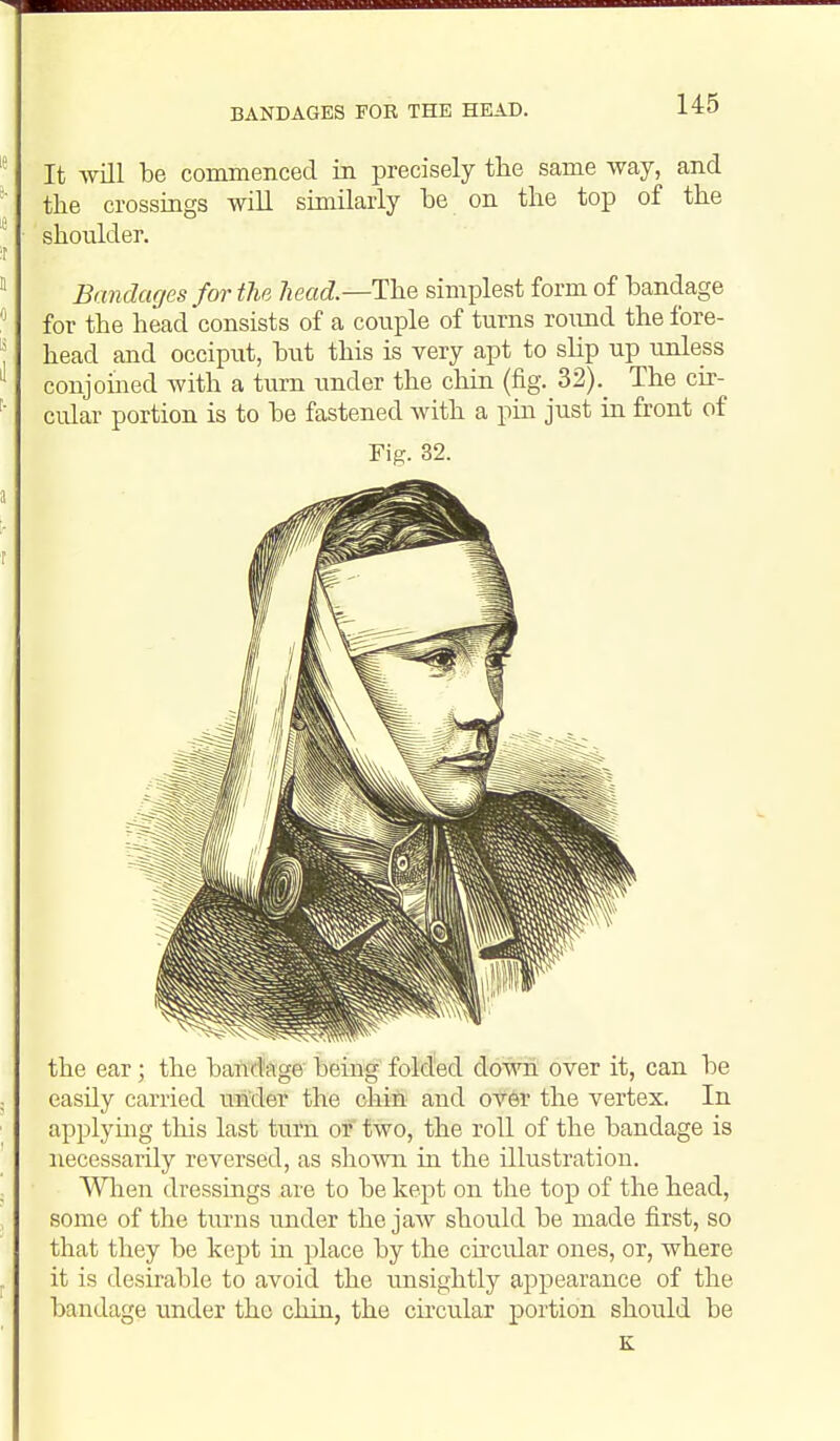 BANDAGES FOR THE HEAD. It wUl be commenced in precisely the same way, and the crossings will sunilaiiy be on the top of the shoulder. Bandages for the Jiead—The simplest form of bandage for the head consists of a couple of turns round the fore- head and occiput, but this is very apt to sKp up unless conjoined with a turn under the chin (fig. 32)._ The cix- cular portion is to be fastened with a pin just in front of Fig. 32. the ear; the bartd'age being foldied dowii over it, can be easily carried under the chin and ov6r the vertex. In applying this last turn or two, the roll of the bandage is necessarily reversed, as shown in the illustration. Wlien dressings are to be kept on the top of the head, some of the turns under the jaw should be made first, so that they be kept in place by the cu'cular ones, or, where it is desirable to avoid the unsightly appearance of the bandage under the chin, the ckcular portion should be