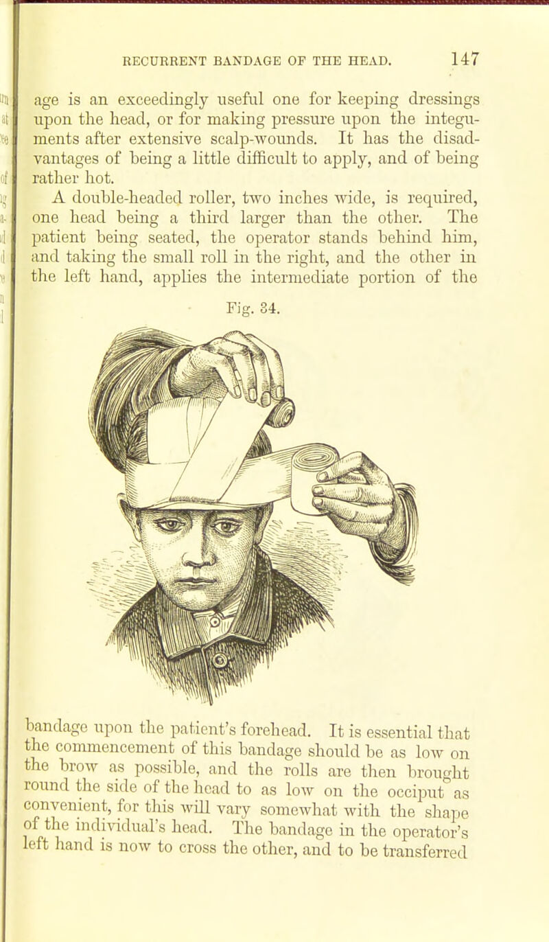 age is an exceedingly useful one for keeping dressings upon the head, or for making pressure upon the integu- ments after extensive scalp-wounds. It has the disad- vantages of being a little difficult to apply, and of being rather hot. A double-headed roller, two inches wide, is required, one head being a third larger than the other. The patient being seated, the operator stands behind him, and taking the small roll in the right, and the other in the left hand, applies the intermediate portion of the Fig. 34. bandage upon the patient's forehead. It is essential that the commencement of this bandage should be as low on the brow as possible, and the rolls are then brought round the side of the head to as low on the occiput as convenient, for this will vary somewhat with the shape of the individual's head. The bandage in the operator's left hand is now to cross the other, and to be transferred