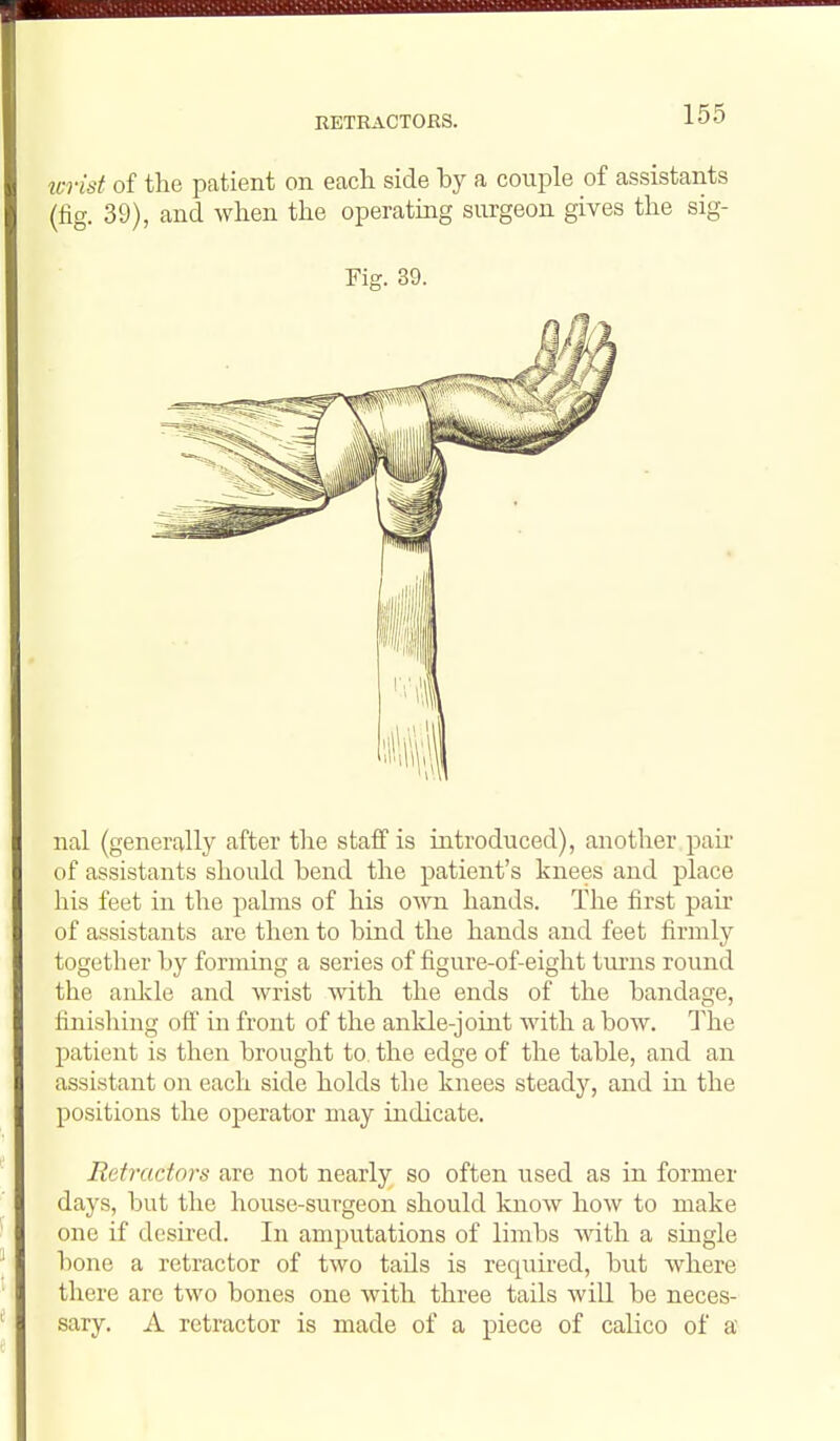 icrid of the patient on each side by a couple of assistants (fig. 39), and when the operating surgeon gives the sig- Fig. 39. nal (generally after the staff is introduced), another pair- of assistants should hend the patient's knees and place his feet in the palms of his own hands. The first pair of assistants are then to bind the hands and feet firmly together by forming a series of figure-of-eight turns round the aiilvle and wrist Avith the ends of the bandage, finishing off in front of the anlde-joint with a bow. The patient is then brought to the edge of the table, and an assistant on each side holds the knees steady, and in the positions the operator may indicate. Retractors are not nearly so often used as in former days, but the house-surgeon should know how to make one if desired. In amputations of limbs with a single bone a retractor of two tails is required, but where there are two bones one with three tails will be neces- sary. A retractor is made of a piece of calico of a