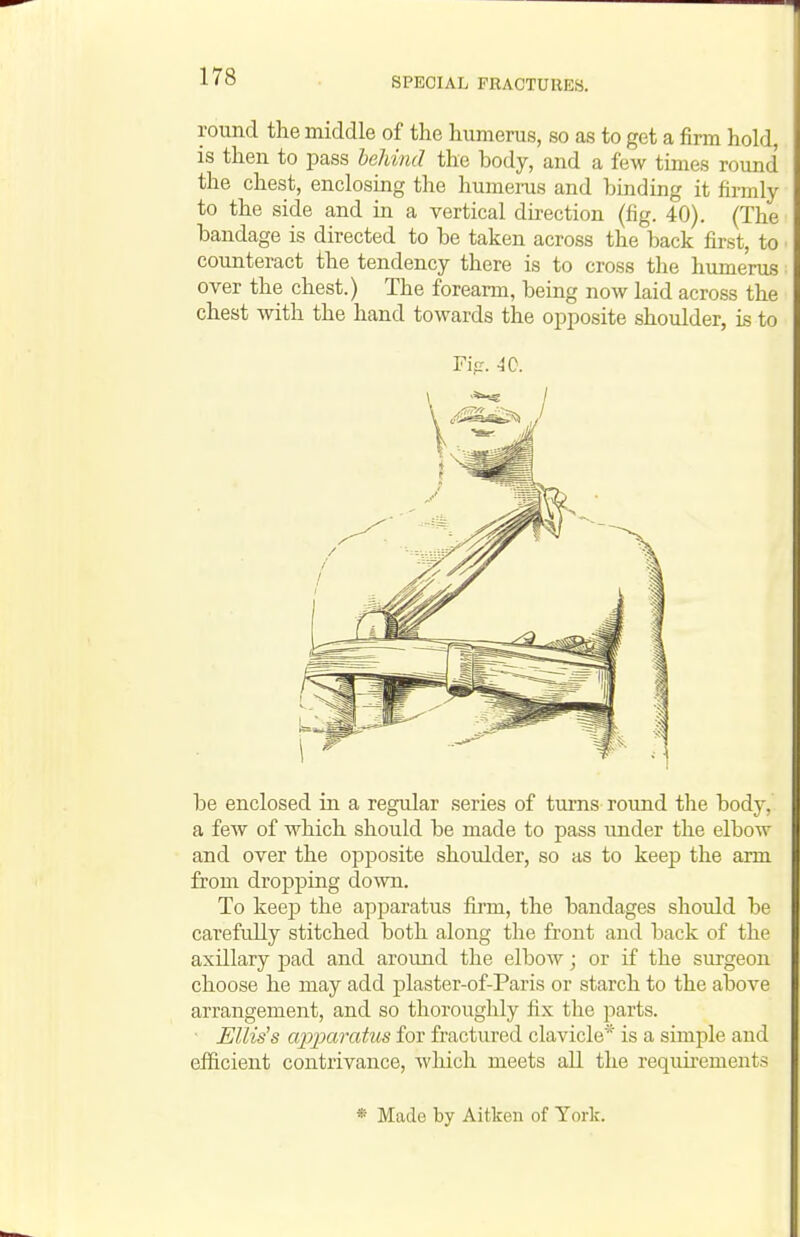 round the middle of the humerus, so as to get a firm hold, is then to pass behind the body, and a few times round the chest, enclosing the humerus and binding it firmly to the side and in a vertical direction (fig. 40). (The bandage is directed to be taken across the back first, to counteract the tendency there is to cross the humerus over the chest.) The forearm, being now laid across the chest with the hand towards the opposite shoulder, is to be enclosed in a regular series of turns round the body, a few of which should be made to pass under the elbow and over the opposite shoulder, so as to keep the arm from dropping down. To keep the apparatus firm, the bandages should be carefully stitched both along the front and back of the axillary pad and around the elbow; or if the surgeon choose he may add plaster-of-Paris or starch to the above arrangement, and so thoroughly fix the parts. Ellis's a2oparatus for fractured clavicle* is a simple and efficient contrivance, which meets all the requirements « Made by Aitken of York.