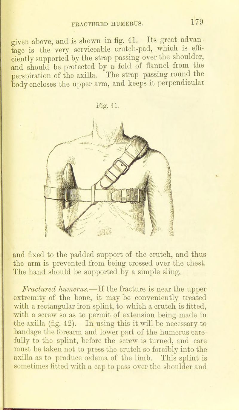 FRACTURED HUMERUS. given above, and is shown in fig. 41. Its great advan- tage is the very serviceable crutch-pad, which is effi- ciently supported by the strap passing over the shoulder, and should be protected by a fold of flannel from the perspiration of the axiUa. The strap passing round the body encloses the upper arm, and keeps it perpendicular Fig. 'Jl. and fixed to the padded support of the crutch, and thus the arm is prevented from being crossed over the chest. The hand should be supported by a simple sling. Fractured hu7nerus.—If the fracture is near the upper extremity of the bone, it may be conveniently treated vnth a rectangular iron splint, to which a crutch is fitted, with a screw so as to permit of extension being made in the axilla (fig. 42). In using this it will be necessary to bandage the forearm and lower part of the humerus care- fully to the splint, before the screw is turned, and care must be taken not to press the crutch so forcibly into the axilla as to produce ojdema of the limb. This splmt is sometimes fitted with a cap to pass over the shoulder and