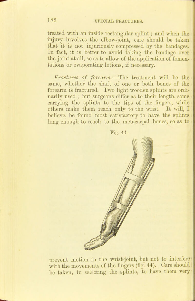 treated with an inside rectangular splint; and when the injury involves the elbow-joint, care should be taken that it is not injuriously compressed by the bandages. In fact, it is better to avoid taking the bandage over the joint at all, so as to allow of the application of fomen- tations or evaporating lotions, if necessary. Fractures of forearm.—The treatment will be the same, whether the shaft of one or both bones of the forearm is fractured. Two light wooden splints are ordi- narily used ; but surgeons differ as to their length, some carrying the splints to the tips of the fingers, while others make them reach only to the wrist. It will, I believe, be found most satisfactory to have the splints long enough to reach to the metacarpal bones, so as to Fig. 41. prevent motion in the wrist-joint, but not to interfere with the movements of the fingers (fig. 44). Care should be taken, in sel-icting the splints, to have them very