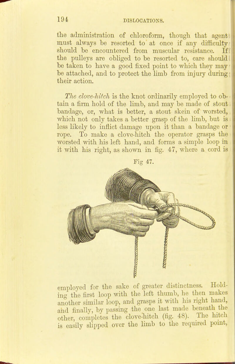 the administration of chloroform, tliough that agent must always be resorted to at once if any difficulty should be encountered from muscular resistanca If: the pulleys are obliged to be resorted to, care should i be taken to have a good fixed point to which they may be attached, and to protect the limb from injury during their action. The clove-liiteli is the knot ordinarily employed to ob- ■ tain a firm hold of the limb, and may be made of stout bandage, or, what is better, a stout skein of Avorsted, Avhich not only takes a better grasp of the liinb, but is less likely to inflict damage upon it than a bandage or rope. To make a clove-hitch the operator grasps the worsted with his left hand, and forms a simple loop in it with his right, as shown in fig. 47, where a cord is Fig 47. employed for the sake of greater distinctness. Hold- ing the first loop with the left thumb, he then makes another similar loop, and grasps it Avitli his right hand, and finally, by passuag the one last made beneath the other, completes the clove-liitch (fig. 48). The hitch is easily slipped over the limb to the required pomt,