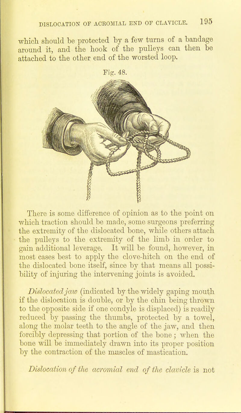 wMcli should be. protected by a few turns of a bandage around it, and the book of the pulleys can then be attached to the other end of the worsted loop. Fig. 48. There is some difference of opinion as to the point on which traction should be made, some surgeons preferring the extremity of the dislocated bone, while others attach the pulleys to the extremity of the limb in order to gain additional leverage. It Anil be foimd, however, in most cases best to apply the clove-hitch on the end of the dislocated bone itself, since by that means all possi- bility of injiu'ing the intervening joints is avoided. Dislocated joM (indicated by the widely gaping mouth if the dislocation is double, or by the chin being throAvn to the opposite side if one condyle is displaced) is readily reduced by passing the thumbs, protected by a towel, along the molar teeth to the angle of the jaAv, and then forcibly depressing that portion of the bone; when the bone Avill be immediately di'awn into its proper position by the contraction of the muscles of mastication. Dislocation of the acromial end of the clavicle is not