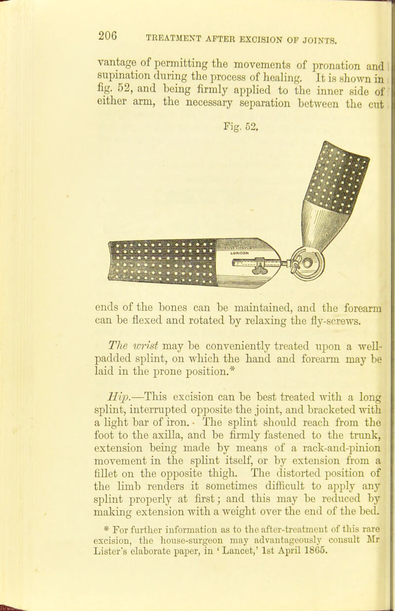 vantage of permitting the movements of pronation and supination during the process of healing. It is shown in fig. 52, and being firmly applied to the inner side of either arm, the necessary separation between the cut Fig. 52. ends of the bones can be maintained, and the forearm can be flexed and rotated by relaxing the fly-srrews. The wrist may be conveniently treated upon a well- padded splint, on which the hand and forearm may be laid in the prone position.* Hi]o.—This excision can be best treated with a long splint, interrupted opijosite the joint, and bracketed with a light bar of iron. • The splint should reach from the foot to the axilla, and be fii-mly fastened to the tnmk, extension being made by means of a rack-and-pmion movement in the splint itself, or by extension fi'om a fillet on the opposite thigh. The distorted position of the limb renders it sometimes difficult to apply any splint j)roperly at first; and this may be reduced by making extension with a weight over the end of the bed. * For further information as to the after-treatment of this rare excision, the liouse-surgeon may advantageously consult Mr Lister's elaborate paper, in ' Lancet,' 1st April 1865.