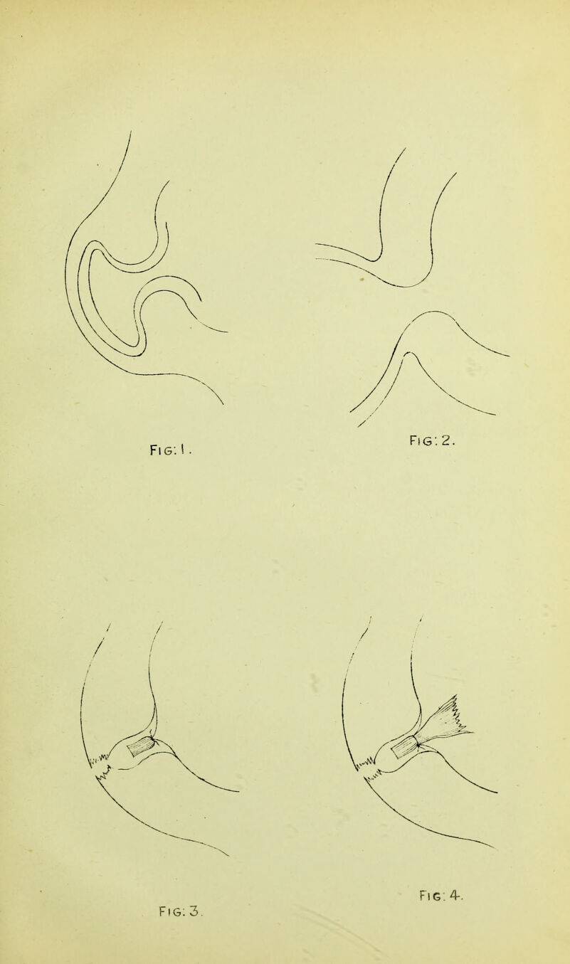 Fig: 4-.