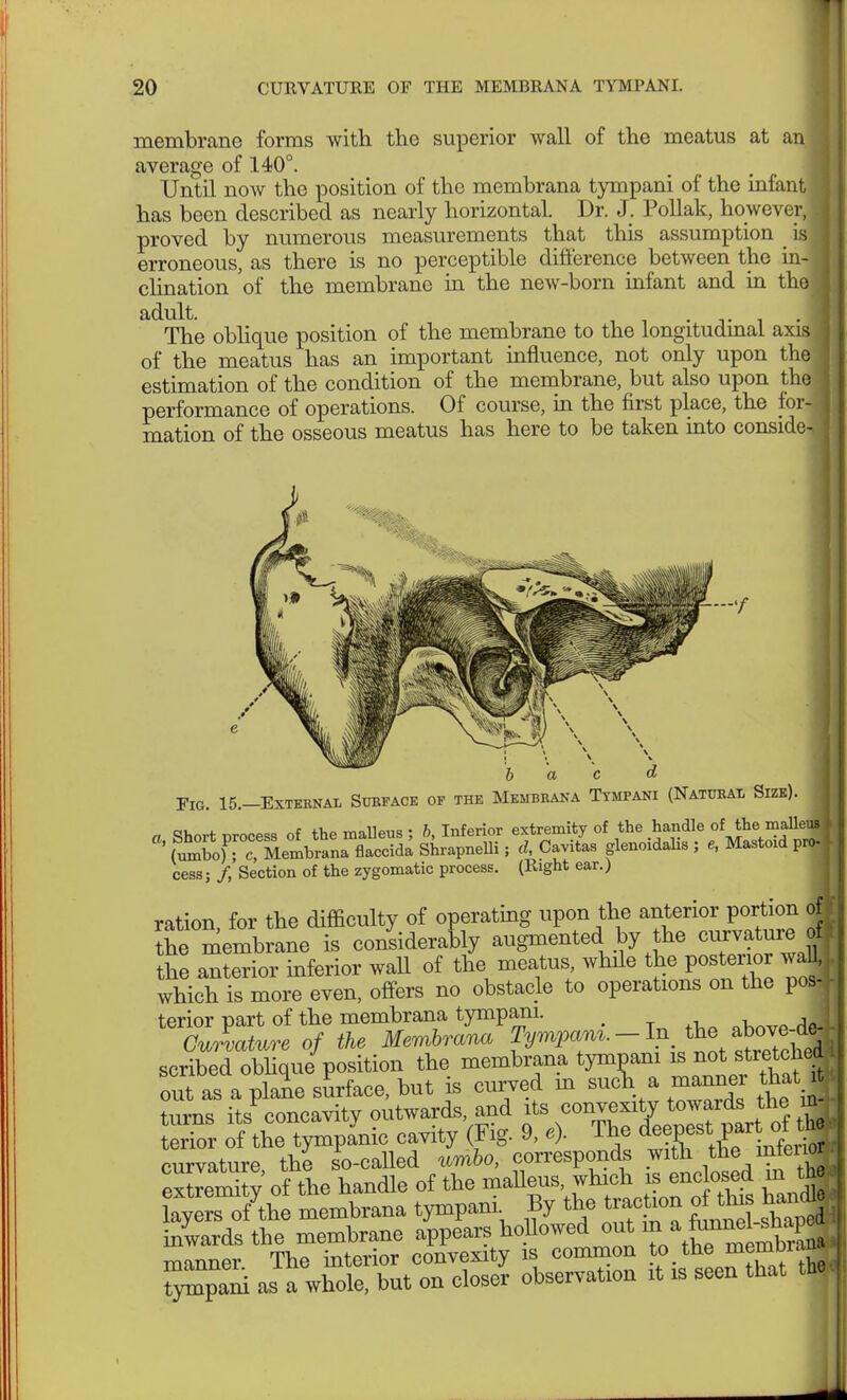 membrane forms with the superior Avail of the meatus at an average of 140°. Until now the position of the membrana tympani of the infant has been described as nearly horizontal. Dr. J. Pollak, however, proved by numerous measurements that this assumption is erroneous, as there is no perceptible difference between the in- clination of the membrane in the new-born infant and in the adult. . . I The oblique position of the membrane to the longitudinal axis of the meatus has an important influence, not only upon the estimation of the condition of the membrane, but also upon the performance of operations. Of course, in the first place, the fori mation of the osseous meatus has here to be taken into consider b a c d Fig. 15,-Extkenal Surface of the Membrana Tympani (Natdbai Sizk). «1. t +1,0 m„iio„s • h Inferior extremity of the handle of the malleus I * fXT: MelwÄ Shrapnem ; rf, Cavils glenoids , , Mastoid prJ cess; /, Section of the zygomatic process. (Right ear.) ration, for the difficulty of operating upon the anterior portion of the membrane is considerably augmented by the curvature ofl the anterior inferior wall of the meatus while the posterior wall, which is more even, offers no obstacle to operations on the pos4 tenor part of the membrana tympani. _ J Curvature of the Membrana ^^-^^^^A scribed oblique position the membrana tympani is not retched out as a plane surface, but is curved m such a mannei that turns its concavity outwards, and its convexity towards the m erTor oltC^Lo cavity (Fig. 9, e). The ^t^J^ curvature the so-called umbo, corresponds with the inteiiof- of the handle of the malleus ^ layers of the membrana tympani. By the traction of tins M inwards the membrane appears hollowed out m a^^^ manner The interior convexity is common to the m™'™ ^pani as a whole, but on closer observation it is seen that tW