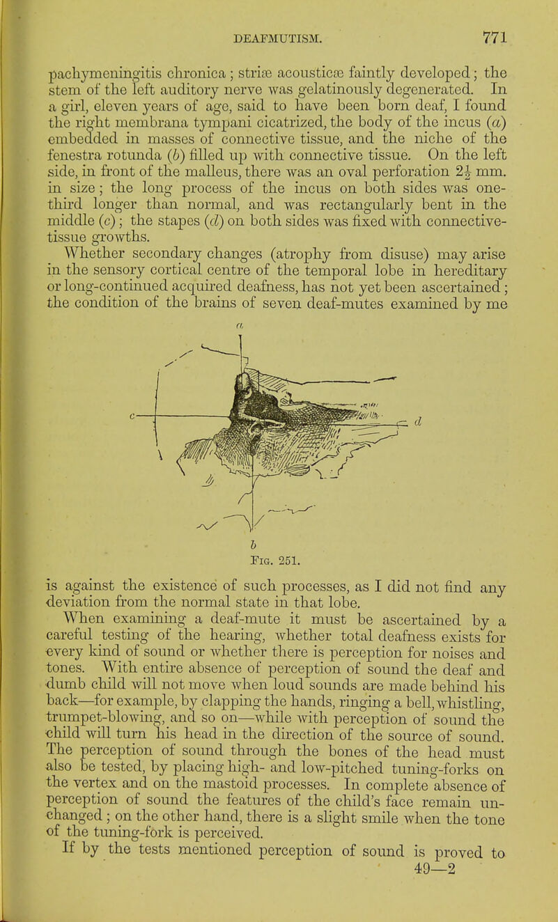 pachymeningitis chronica ; strise acousticoe faintly developed; the stem of the left auditory nerve was gelatinously degenerated. In a girl, eleven years of age, said to have been born deaf, I found the right membrana tympani cicatrized, the body of the incus (a) embedded in masses of connective tissue, and the niche of the fenestra rotunda (b) filled up with connective tissue. On the left side, in front of the malleus, there was an oval perforation 2£ mm. in size; the long process of the incus on both sides was one- third longer than normal, and was rectangularly bent in the middle (c); the stapes (d) on both sides was fixed with connective- tissue growths. Whether secondary changes (atrophy from disuse) may arise in the sensory cortical centre of the temporal lobe in hereditary or long-continued acquired deafness, has not yet been ascertained; the condition of the brains of seven deaf-mutes examined by me a d b Fig. 251. is against the existence of such processes, as I did not find any deviation from the normal state in that lobe. When examining a deaf-mute it must be ascertained by a careful testing of the hearing, whether total deafness exists for every kind of sound or whether there is perception for noises and tones. With entire absence of perception of sound the deaf and dumb child will not move when loud sounds are made behind his back—for example, by clapping the hands, ringing a bell, whistling, trumpet-blowing, and so on—while with perception of sound the child will turn his head in the direction of the source of sound. The perception of soimd through the bones of the head must also be tested, by placing high- and low-pitched tuning-forks on the vertex and on the mastoid processes. In complete absence of perception of sound the features of the child's face remain un- changed ; on the other hand, there is a slight smile when the tone of the tuning-fork is perceived. If by the tests mentioned perception of sound is proved to 49—2