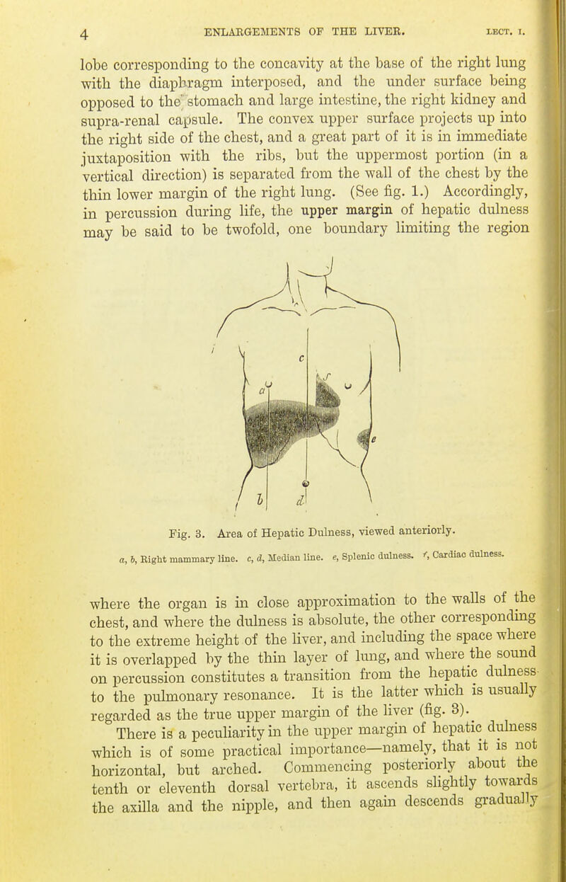 lobe corresponding to the concavity at the base of the right lung with the diaphragm interposed, and the under surface being opposed to the' stomach and large intestine, the right kidney and supra-renal capsule. The convex upper surface projects up into the right side of the chest, and a great part of it is in immediate juxtaposition with the ribs, but the uppermost portion (in a vertical direction) is separated from the wall of the chest by the thin lower margin of the right lung. (See fig. 1.) Accordingly, in percussion during life, the upper margin of hepatic dulness may be said to be twofold, one boundary limiting the region Fig. 3. Area of Hepatic Dulness, viewed anteriorly. a, b, Eight mammary line, c, d, Median line, e, Splenic dulness. f, Cardiac where the organ is in close approximation to the walls of the chest, and where the dulness is absolute, the other corresponding to the extreme height of the liver, and including the space where it is overlapped by the thin layer of lung, and where the sound on percussion constitutes a transition from the hepatic dulness to the pulmonary resonance. It is the latter which is usually regarded as the true upper margin of the liver (fig. 3). There is a peculiarity in the upper margin of hepatic dulness which is of some practical importance—namely, that it is not horizontal, but arched. Commencing posteriorly about the tenth or eleventh dorsal vertebra, it ascends slightly towards the axilla and the nipple, and then again descends gradually