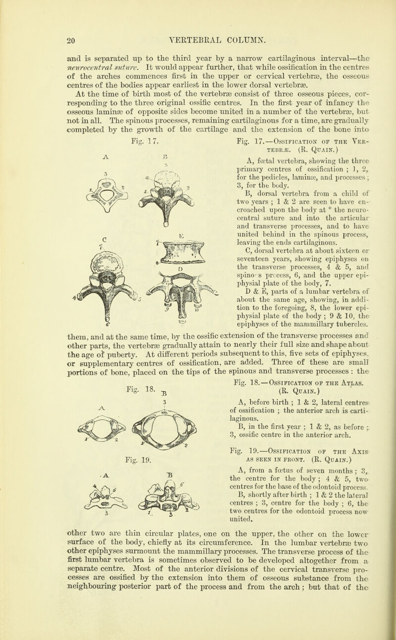 and is separated up to the third year by a narrow cartilaginous interval—the neurocentral suture. It would appear further, that while ossification in the centres of the arches commences first in the upper or cervical vertebras, the osseous centres of the bodies appear earliest in the lower dorsal vertebrae. At the time of birth most of the vertebrae consist of three osseous pieces, cor¬ responding to the three original ossific centres. In the first year of infancy the osseous laminae of opposite sides become united in a number of the vertebrae, but not in all. The spinous processes, remaining cartilaginous for a time, are gradually completed by the growth of the cartilage and the extension of the bone into Fig. 17. A J-J Fig. 17.—Ossification of the Ver¬ tebrae. (R. Quain.) A, foetal vertebra, showing the three primary centres of ossification ; 1, 2,. for the pedicles, laminae, and processes ; 3, for the body. B, dorsal vertebra from a child of two years ; 1 & 2 are seen to have en¬ croached upon the body at * the neuro¬ central suture and into the articular and transverse processes, and to have united behind in the spinous process,, leaving the ends cartilaginous. C, dorsal vertebra at about sixteen or seventeen years, showing epiphyses on the transverse processes, 4 & 5, and spines process, 6, and the upper epi¬ physial plate of the body, 7. D & E, parts of a lumbar vertebra of about the same age, showing, in addi¬ tion to the foregoing, 8, the lower epi¬ physial plate of the body ; 9 & 10, the epiphyses of the mammillary tubercles. them, and at the same time, by the ossific extension of the transverse processes and other parts, the vertebrae gradually attain to nearly their full size and shape about the age o£ puberty. At different periods subsequent to this, five sets of epiphyses, or supplementary centres of ossification, are added. Three of these are small portions of bone, placed on the tips of the spinous and transverse processes : the Fig. 18. Fig. 19. Fig. 18.—Ossification of the Atlas. (R. Quain.) A, before birth ; 1 & 2, lateral centres of ossification ; the anterior arch is carti¬ laginous. B, in the first year ; 1 & 2, as before ; 3, ossific centre in the anterior arch. Fig. 19.—Ossification of the Axis as seen in front. (R. Quain.) A, from a foetus of seven months ; 3, the centre for the body ; 4 & 5, two- centres for the base of the odontoid process. B, shortly after birth ; 1 & 2 the lateral centres ; 3, centre for the body ; 6, the two centres for the odontoid process now united. other two are thin circular plates, one on the upper, the other on the lower surface of the body, chiefly at its circumference. In the lumbar vertebrae two other epiphyses surmount the mammillary processes. The transverse process of the first lumbar vertebra is sometimes observed to be developed altogether from a separate centre. Most of the anterior divisions of the cervical transverse pro¬ cesses are ossified by the extension into them of osseous substance from the neighbouring posterior part of the process and from the arch ; but that of the