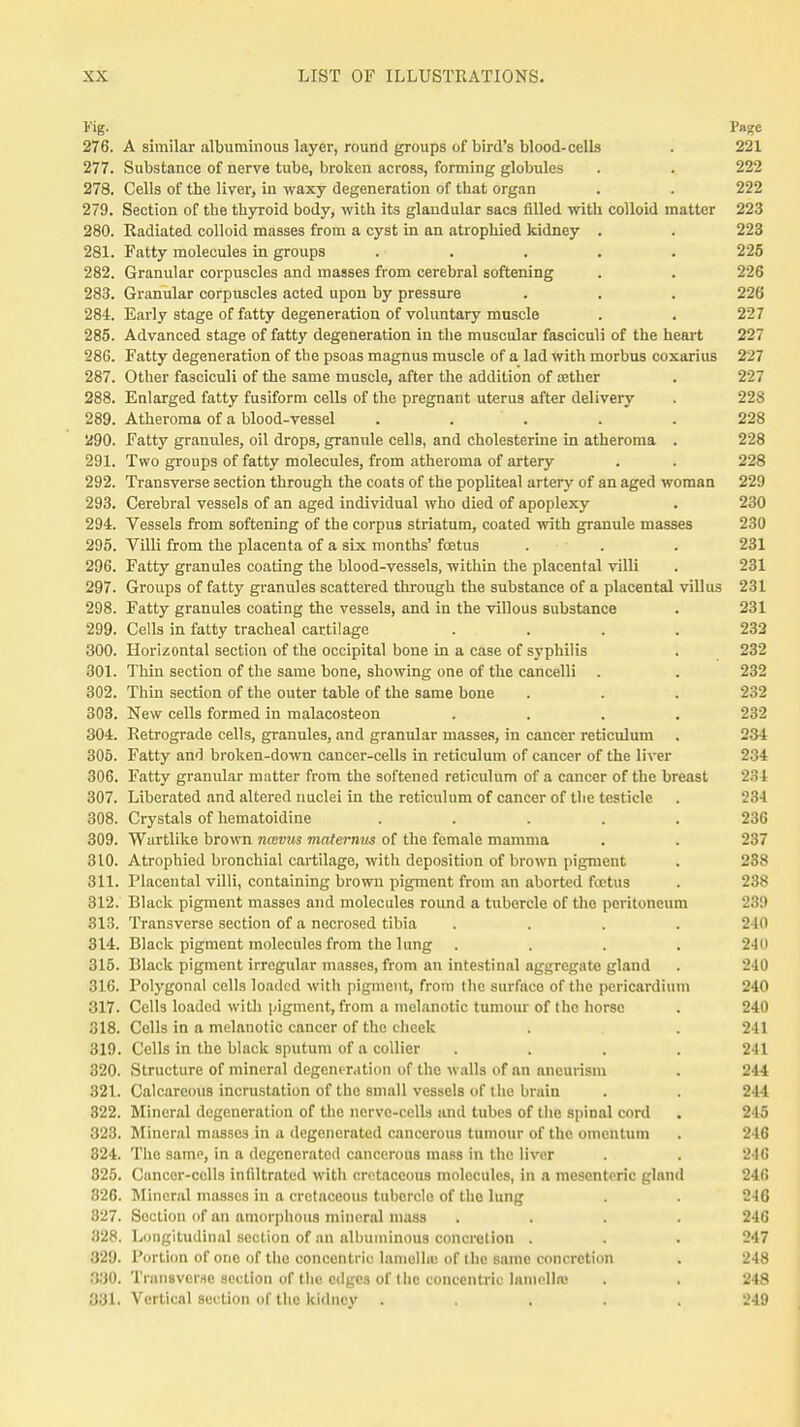 Fig. Page 276. A similar albuminous layer, round groups of bird's blood-cells . 221 277. Substance of nerve tube, broken across, forming globules . . 222 278. Cells of the liver, in waxy degeneration of that organ . . 222 279. Section of the thyroid body, with its glandular sacs filled with colloid matter 223 280. Radiated colloid masses from a cyst in an atrophied kidney . . 223 281. Fatty molecules in groups ..... 225 282. Granular corpuscles and masses from cerebral softening . . 226 283. Granular corpuscles acted upon by pressure . . . 226 284. Early stage of fatty degeneration of voluntary muscle . . 227 285. Advanced stage of fatty degeneration in the muscular fasciculi of the heart 227 286. Fatty degeneration of the psoas magnus muscle of a lad with morbus coxarius 227 287. Other fasciculi of the same muscle, after the addition of asther . 227 288. Enlarged fatty fusiform cells of the pregnant uterus after delivery . 228 289. Atheroma of a blood-vessel ..... 228 290. Fatty granules, oil drops, granule cells, and cholesterine in atheroma . 228 291. Two groups of fatty molecules, from atheroma of artery . . 228 292. Transverse section through the coats of the popliteal artery of an aged woman 229 293. Cerebral vessels of an aged individual who died of apoplexy . 230 294. Vessels from softening of the corpus striatum, coated with granule masses 230 295. Villi from the placenta of a six months' foetus . . . 231 296. Fatty granules coating the blood-vessels, within the placental villi . 231 297. Groups of fatty granules scattered through the substance of a placental villus 231 298. Fatty granules coating the vessels, and in the villous substance . 231 299. Cells in fatty tracheal cartilage .... 232 300. Horizontal section of the occipital bone in a case of syphilis . 232 301. Thin section of the same bone, showing one of the cancelli . . 232 302. Thin section of the outer table of the same bone . . . 232 303. New cells formed in malacosteon .... 232 304. Retrograde cells, granules, and granular masses, in cancer reticulum . 234 305. Fatty and broken-down cancer-cells in reticulum of cancer of the liver 234 306. Fatty granular matter from the softened reticulum of a cancer of the breast 234 307. Liberated and altered nuclei in the reticulum of cancer of the testicle . 284 308. Crystals of hematoidine ..... 236 309. Wartlike brown nccvus maternus of the female mamma . . 237 310. Atrophied bronchial cartilage, with deposition of brown pigment . 288 811. Placental villi, containing brown pigment from an aborted foetus . -■'>* 312. Black pigment masses and molecules round a tubercle of the peritoneum 239 313. Transverse section of a necrosed tibia . . . . 24(1 314. Black pigment molecules from the lung .... 240 315. Black pigment irregular masses, from an intestinal aggregate gland . 240 316. Polygonal cells loaded with pigment, from the surface of the pericardium 240 317. Cells loaded with pigment, from a melanotic tumour of the horse . 240 318. Cells in a melanotic cancer of the cheek . . 241 319. Cells in the black sputum of a collier .... 241 320. Structure of mineral degeneration of the walls of an aneurism . 244 321. Calcareous incrustation of the small vessels of the bruin . . 244 322. Mineral degeneration of the nerve-cells and tubes of the spinal cord . 215 323. Mineral masses in a degenerated cancerous tumour of the omentum . 246 324. The same, in a degenerated cancerous mass in the liver . . 246 825. Cancer-cells infiltrated with cretaceous molecules, in a mesenteric gland 246 326. Mineral masses in a cretaceous tubercle of the lung . . 216 327. Section of an amorphous mineral mass .... 246 328. Longitudinal section of an albuminous concretion . . . 247 329. Portion of one of tho concentric lamella of the same concretion . 248 330. Transverse section of the edges of t lie concentric lamella! . . 248 331. Vertical section of the kidney ..... 249