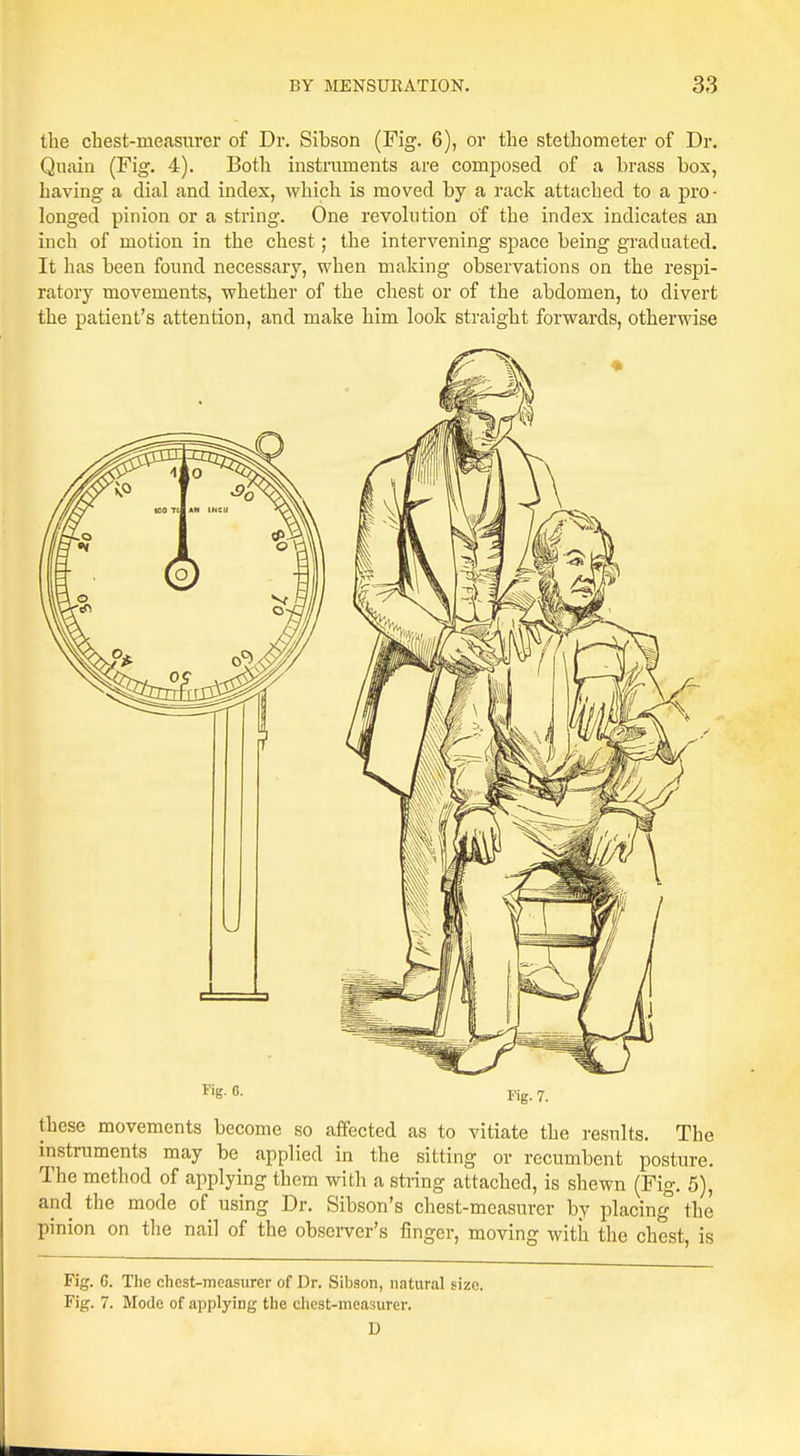 the chest-measurer of Dr. Sibson (Fig. 6), or the stethometer of Dr. Quain (Fig. 4). Both instruments are composed of a brass box, having a dial and index, which is moved by a rack attached to a pro- longed pinion or a string. One revolution of the index indicates an inch of motion in the chest; the intervening space being graduated. It has been found necessary, when making observations on the respi- ratory movements, whether of the chest or of the abdomen, to divert the patient's attention, and make him look straight forwards, otherwise rig. 6. Kg. 7 these movements become so affected as to vitiate the results. The instruments may be applied in the sitting or recumbent posture. The method of applying them with a string attached, is shewn (Fig. 5), and the mode of using Dr. Sibson's chest-measurer by placing the pinion on the nail of the observer's finger, moving with the chest, is Fig. G. The chcst-mcasurer of Dr. Sibson, natural size. Fig. 7. Mode of applying the chest-measurer. U