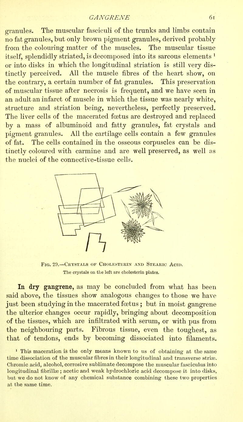 granules. The muscular fasciculi of the trunks and limbs contain no fat granules, but only brown pigment granules, derived probably from the colouring matter of the muscles. The muscular tissue itself, splendidly striated, is decomposed into its sarcous elements 1 or into disks in which the longitudinal striation is still very dis- tinctly perceived. All the muscle fibres of the heart show, on the contrary, a certain number of fat granules. This preservation of muscular tissue after necrosis is frequent, and we have seen in an adult an infarct of muscle in which the tissue was nearly white, structure and striation being, nevertheless, perfectly preserved. The liver cells of the macerated fœtus are destroyed and replaced by a mass of albuminoid and fatty granules, fat crystals and pigment granules. All the cartilage cells contain a few granules of fat. The cells contained in the osseous corpuscles can be dis- tinctly coloured with carmine and are well preserved, as well as the nuclei of the connective-tissue cells. Fig. 29.—Crystals of Cholesterin and Stearic Acid. The crystals on the left are cholesterin plates. In dry gangrene, as may be concluded from what has been said above, the tissues show analogous changes to those we have just been studying in the macerated foetus ; but in moist gangrene the ulterior changes occur rapidly, bringing about decomposition of the tissues, which are infiltrated with serum, or with pus from the neighbouring parts. Fibrous tissue, even the toughest, as that of tendons, ends by becoming dissociated into filaments. 1 This maceration is the only means known to us of obtaining at the same time dissociation of the muscular fibres in their longitudinal and transverse strias, Chromic acid, alcohol, corrosive sublimate decompose the muscular fasciculus into longitudinal fibrillse ; acetic and weak hydrochloric acid decompose it into disks, but we do not know of any chemical substance combining these two properties at the same time.